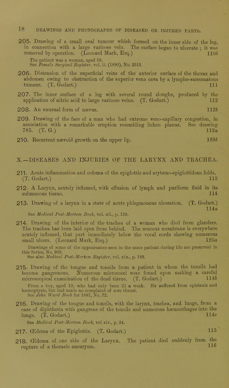 205. Drawing of a small oval tumour which formed on the inner side of the leg, in connection with a large varicose vein. The surface began to ulcerate ; it was removed by operation. (Leonard Mark, Esq.) 1106 The patient was a woman, aged 58. See Female Surgical Register, vol. ii. (1890), No. 2515. 206. Distension of the superficial veins of the anterior surface of the thorax and abdomen owing to obstruction of the superior vena cava by a lymplio-sarcomatous tumour. (T. Godart.) Ill 207. The inner surface of a leg with several round sloughs, produced by the application of nitric acid to large varicose veins. (T. Godart.) 112 208. An unusual form of nevus. 1126 209. Drawing of the face of a man who had extreme veno-capillary congestion, in association with a remarkable eruption resembling lichen planus. See drawing 785. (T. G.) 112a 210. Recurrent nevoid growth on the upper lip. 1896 X.—DISEASES AND INJURIES OF THE LARYNX AND TRACHEA. 211. Acute inflammation and cedema of the epiglottis and aryteno-epiglottidean folds. (T. Godart.) 113 212. A Larynx, acutely inflamed, with effusion of lymph and puriform fluid in its submucous tissue. 114 213. Drawing of a larynx in a state of acute phlegmonous ulceration. (T. Godart.) 114a See Medical Post-Mortem Book, vol. xii., p. 139. 214. Drawing of the interior of the trachea of a woman who died from glanders. The trachea has been laid open from behind. The mucous membrane is everywhere acutely inflamed, that part immediately below the vocal cords showing numerous small ulcers. (Leonard Mark, Esq.) 125a Drawings of some of the appearances seen in the same patient during life are preserved in this Series, No. 903. See also Medical Post-Mortem Register, vol. xix., p. 189. 215. Drawing of the tongue and tonsils from a patient in whom the tonsils had become gangrenous. Numerous micrococci were found upon making a careful microscopical examination of the dead tissue. (T. Godart.) 1146 From a boy, aged 19, who had only been ill a week. He suffered from epistaxis and hemoptysis, but had made no complaint of sore throat. See John Ward Rook for 1887, No. 72. 216. Drawing of the tongue and tonsils, with the larynx, trachea, and lungs, from a case of diphtheria with gangrene of the tonsils and numerous hemorrhages into the lungs. (T. Godart.) 114c See Medical Post-Mortem Book, vol xiv., p. 24. 217. CEdema of the Epiglottis. (T. Godart.) 115 218. GEdema of one side of the Larynx. The patient died suddenly from the rupture of a thoracic aneurysm. 116