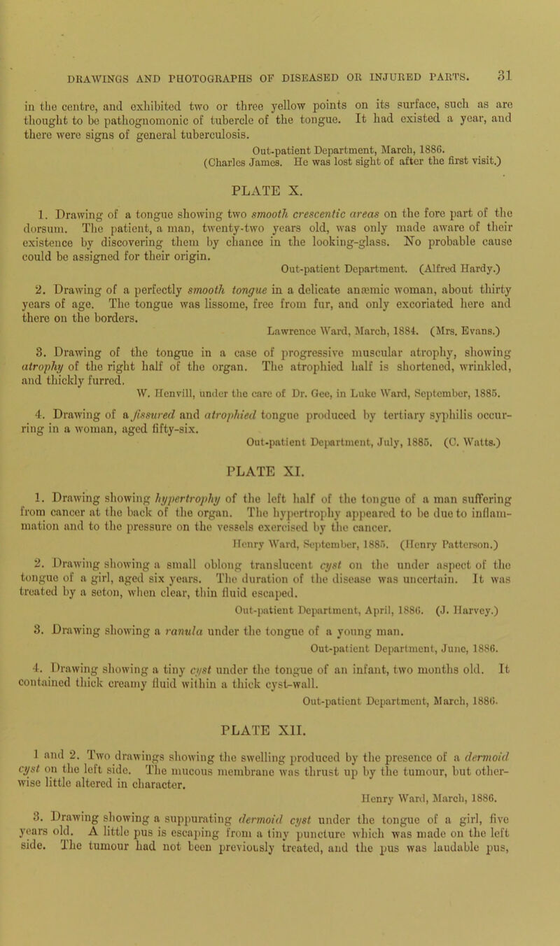 in the centre, and exhibited two or throe yellow points on its surface, such as are thought to bo pathognomonic of tubercle of the tongue. It had existed a year, and there were signs of general tuberculosis. Out-patient Department, March, 1886. (Charles James. He was lost sight of after the first visit.) PLATE X. 1. Drawing of a tongue showing two smooth crescentic areas on the fore part of the dorsum. The patient, a man, twenty-two years old, was only made aware of their existence by discovering them by chance in the looking-glass. No probable cause could be assigned for their origin. Out-patient Department. (Alfred Hardy.) 2. Drawing of a perfectly smooth tongue in a delicate anaemic woman, about thirty years of age. The tongue was lissome, free from fur, and only excoriated here and there on the borders. Lawrence Ward, March, 1884. (Mrs. Evans.) 3. Drawing of the tongue in a case of progressive muscular atrophy, showing atrophy of the right half of the organ. The atrophied half is shortened, wrinkled, and thickly furred. W. Henvill, under the care of Dr. Gee, in Luke Ward, September, 1885. 4. Drawing of a fissured and atrophied tongue produced by tertiary syphilis occur- ring in a woman, aged fifty-six. Out-patient Department, July, 1885. (C. Watts.) PLATE XI. 1. Drawing showing hypertrophy of the left half of the tongue of a man suffering from cancer at the back of the organ. The hypertrophy appenred to be duo to inflam- mation and to the pressure on the vessels exercised by the cancer. Henry Ward, September, 1885. (Henry Patterson.) 2. Drawing showing a small oblong translucent, cyst on the under aspect of the tongue of a girl, aged six years. The duration of the disease was uncertain. It was treated by a seton, when clear, thin fluid escaped. Out-patient Department, April, 1886. (J. Harvey.) 3. Drawing showing a ranula under the tongue of a young man. Out-patient Department, June, 1886. 4. Drawing showing a tiny cyst under the tongue of an infant, two months old. It contained thick creamy fluid within a thick cyst-wall. Out-patient Department, March, 1886. PLATE XII. 1 and 2. Two drawings showing the swelling produced by the presence of a dermoid cyst on the left side. The mucous membrane was thrust up by the tumour, but other- wise little altered in character. Henry Ward, March, 1886. 3. Drawing showing a suppurating dermoid cyst under the tongue of a girl, five years old. A little pus is escaping from a tiny puncture which was made on the left side. The tumour had not been previously treated, and the pus was laudable pus,