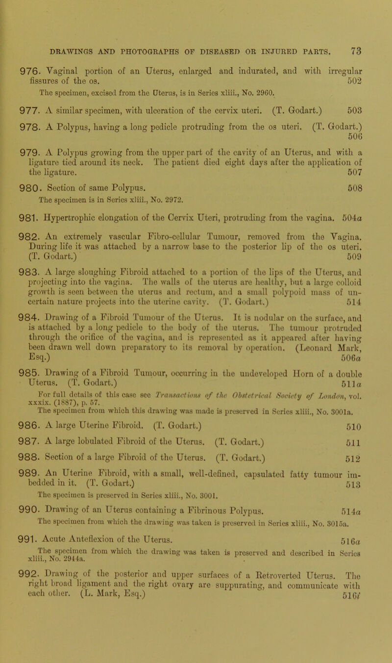 976. Vaginal portion of an Uterus, enlarged and indurated, and with irregular fissures of the os. 502 The specimen, excised from the Uterus, is in Series xliii., No. 2960. 977. A similar specimen, with ulceration of the cervix uteri. (T. Godart.) 503 978. A Polypus, having a long pedicle protruding from the os uteri. (T. Godart.) 500 979. A Polypus growing from the upper part of the cavity of an Uterus, and with a ligature tied around its neck. The patient died eight days after the application of the ligature. 507 980. Section of same Polypus. The specimen is in Series xliii., No. 2972. 508 981. Hypertrophic elongation of the Cervix Uteri, protruding from the vagina. 504a 982. An extremely vascular Fibro-cellular Tumour, removed from the Vagina. During life it was attached by a narrow base to the posterior lip of the os uteri. (T. Godart.) 509 983. A large sloughing Fibroid attached to a portion of the lips of the Uterus, and projecting into the vagina. The walls of the utorus are healthy, but a large colloid growth is seen between the uterus and rectum, and a small polypoid mass of un- certain nature projects into the uterine cavity. (T. Godart.) 514 984. Drawing of a Fibroid Tumour of the Uterus. It is nodular on the surface, and is attached by a long pedicle to the body of the uterus. The tumour protruded through the orifico of the vagina, and is represented as it appeared aftor having been drawn well down preparatory to its removal by operation. (Leonard Mark, Esq.) ' ' 506a 985. Drawing of a Fibroid Tumour, occurring in the undeveloped Horn of a double Utorus. (T. Godart.) 511a For full details of this case see Transactions of the Obstetrical Society of London, \ol. xxxix. (1887), p. 67. The specimen from which this drawing wns made is preserved in Series xliii., No. 3001a. 986. A large Uterine Fibroid. (T. Godart.) 510 987. A large lobulated Fibroid of the Uterus. (T. Godart.) 511 988- Section of a largo Fibroid of the Uterus. (T. Godart.) 512 989- An Uterine Fibroid, with a small, well-defined, capsulated fatty tumour im- bedded in it. (T. Godart.) 513 The specimen is preserved in Series xliii., No. 3001. 990. Drawing of an Uterus containing a Fibrinous Polypus. 514a The specimen from which the drawing was taken is preserved in Series xliii., No. 3016a. 991. Acute Anteflexion of the Uterus. 516a The specimen from which the drawing was taken is preserved and described in Series xliii., No. 2914a. 992. Drawing of the posterior and upper surfaces of a Retroverted Uterus. The right broad ligament and the right ovary are suppurating, and communicate with eacli other. (L. Mark, Esq.)  51Gf