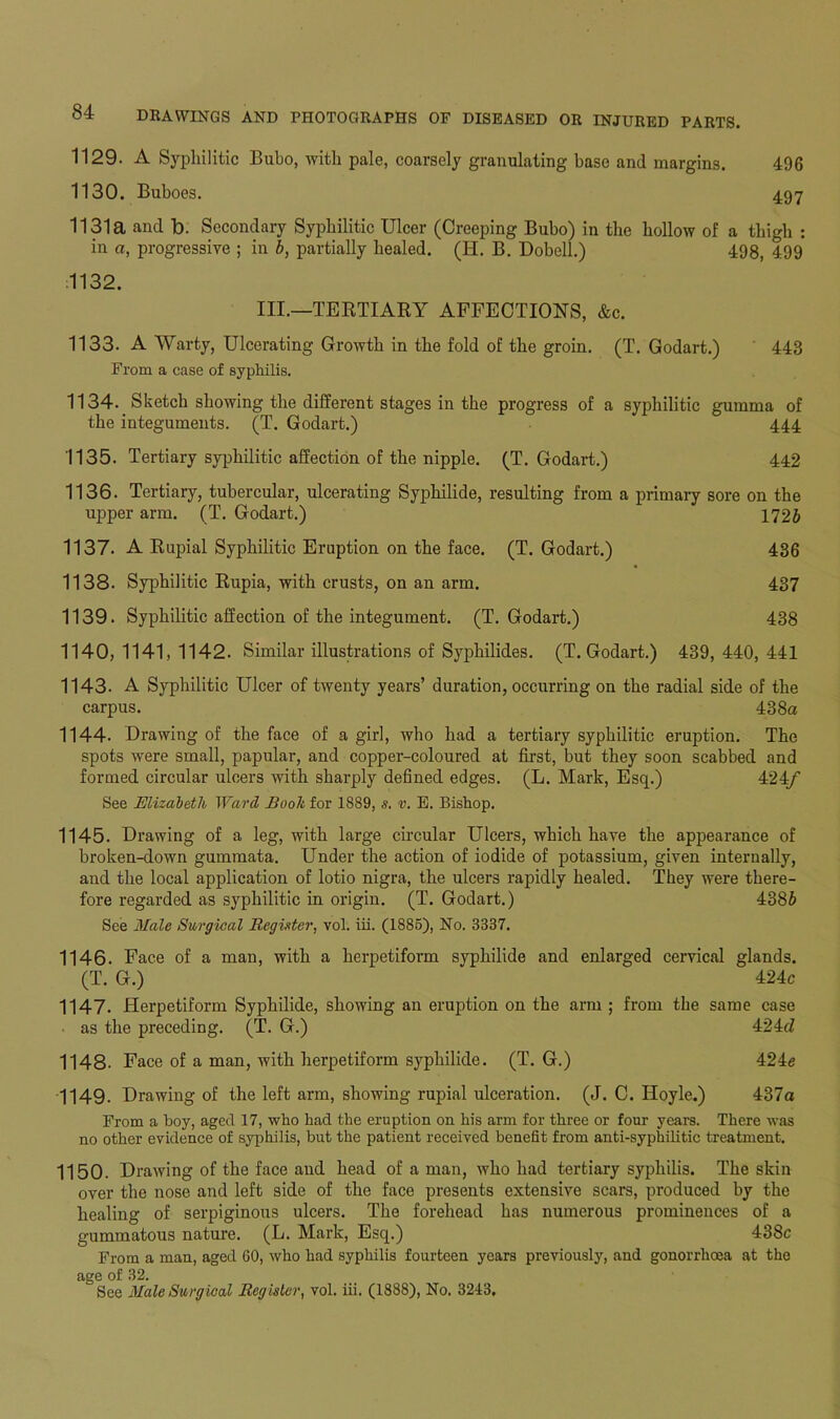 1129. A Syphilitic Bubo, with pale, coarsely granulating base and margins. 496 1130. Buboes. 497 1131a and b. Secondary Syphilitic Ulcer (Creeping Bubo) in the hollow of a thigh : in a, progressive ; in b, partially healed. (Id. B. Dobell.) 498, 499 1132. III.—TERTIARY AFFECTIONS, &c. 1133. A Warty, Ulcerating Growth in the fold of the groin. (T. Godart.) 443 From a case of syphilis. 1134. Sketch showing the different stages in the progress of a syphilitic gumma of the integuments. (T. Godart.) 444 1135. Tertiary syphilitic affection of the nipple. (T. Godart.) 442 1136. Tertiary, tubercular, ulcerating Syphilide, resulting from a primary sore on the upper arm. (T. Godart.) 1726 1137. A Rupial Syphilitic Eruption on the face. (T. Godart.) 436 1138. Syphilitic Rupia, with crusts, on an arm. 437 1139. Syphilitic affection of the integument. (T. Godart.) 438 1140. 1141, 1142. Similar illustrations of Syphilides. (T. Godart.) 439, 440, 441 1143. A Syphilitic Ulcer of twenty years’ duration, occurring on the radial side of the carpus. 438a 1144. Drawing of the face of a girl, who had a tertiary syphilitic eruption. The spots were small, papular, and copper-coloured at first, but they soon scabbed and formed circular ulcers with sharply defined edges. (L. Mark, Esq.) 424/ See Elizabeth Ward Booh for 1889, s. v. E. Bishop. 1145. Drawing of a leg, with large circular Ulcers, which have the appearance of broken-down gummata. Under the action of iodide of potassium, given internally, and the local application of lotio nigra, the ulcers rapidly healed. They were there- fore regarded as syphilitic in origin. (T. Godart.) 4386 See Male Surgical Register, vol. iii. (1885), No. 3337. 1146. Face of a man, with a herpetiform syphilide and enlarged cervical glands. (T. G.) 424c 1147. Herpetiform Syphilide, showing an eruption on the arm ; from the same case as the preceding. (T. G.) 424d 1148. Face of a man, with herpetiform syphilide. (T. G.) 424c 1149. Drawing of the left arm, showing rupial ulceration. (J. C. Hoyle.) 437a From a boy, aged 17, who had the eruption on his arm for three or four years. There was no other evidence of syphilis, hut the patient received benefit from anti-syphilitic treatment. 1150. Drawing of the face and head of a man, who had tertiary syphilis. The skin over the nose and left side of the face presents extensive scars, produced by the healing of serpiginous ulcers. The forehead has numerous prominences of a gummatous nature. (L. Mark, Esq.) 438c From a man, aged 60, who had syphilis fourteen years previously, and gonorrhoea at the age of 32. See Male Surgical Register, vol. iii. (1888), No. 3213.