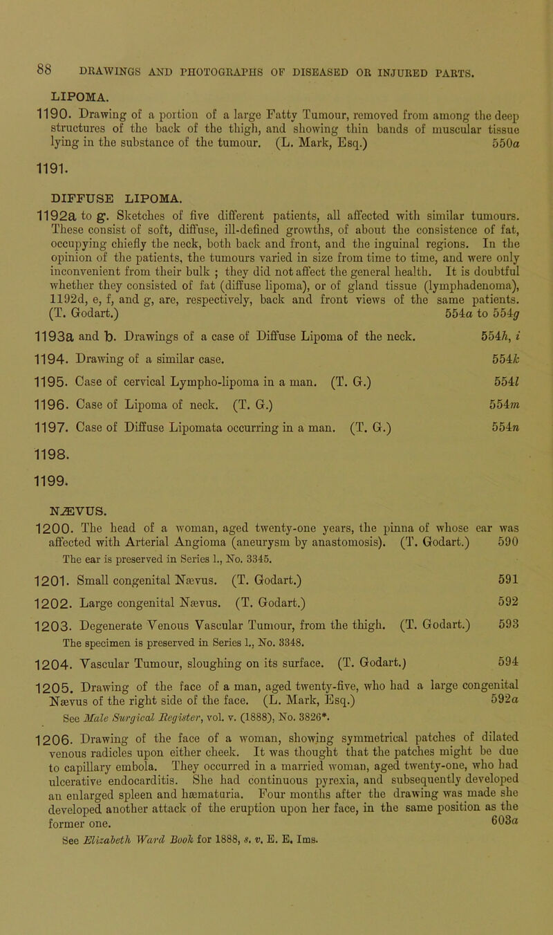 LIPOMA. 1190. Drawing of a portion of a large Fatty Tumour, removed from among the deep structures of the back of the thigh, and showing thin bands of muscular tissue lying in the substance of the tumour. (L. Mark, Esq.) 550a 1191. DIFFUSE LIPOMA. 1192a to g. Sketches of five different patients, all affected with similar tumours. These consist of soft, diffuse, ill-defined growths, of about the consistence of fat, occupying chiefly the neck, both back and front, and the inguinal regions. In the opinion of the patients, the tumours varied in size from time to time, and were only inconvenient from their bulk ; they did not affect the general health. It is doubtful whether they consisted of fat (diffuse lipoma), or of gland tissue (lymphadenoma), 1192d, e, f, and g, are, respectively, back and front views of the same patients. (T. Godart.) 554a to 554<7 1193a and D. Drawings of a case of Diffuse Lipoma of the neck. 554h, i 1194. Drawing of a similar case. 554& 1195. Case of cervical Lympho-lipoma in a man. (T. G.) 554f 1196. Case of Lipoma of neck. (T. G.) 554?« 1197. Case of Diffuse Lipomata occurring in a man. (T. G.) 554ra 1198. 1199. NJEVUS. 1200. The head of a woman, aged twenty-one years, the pinna of whose ear was affected with Arterial Angioma (aneurysm by anastomosis). (T. Godart.) 590 The ear is preserved in Series 1., No. 3345. 1201. Small congenital Namis. (T. Godart.) 591 1202. Large congenital Nrnvus. (T. Godart.) 592 1203. Degenerate Venous Vascular Tumour, from the thigh. (T. Godart.) 593 The specimen is preserved in Series 1., No. 3348. 1204. Vascular Tumour, sloughing on its surface. (T. Godart.) 594 1205. Drawing of the face of a man, aged twenty-five, who had a large congenital Nmvus of the right side of the face. (L. Mark, Esq.) 592a See Male Surgical Register, vol. v. (1888). No. 382G*. 1206. Drawing of the face of a woman, showing symmetrical patches of dilated venous radicles upon either cheek. It was thought that the patches might be due to capillary ernbola. They occurred in a married woman, aged twenty-one, who had ulcerative endocarditis. She had continuous pyrexia, and subsequently developed an enlarged spleen and liaunaturia. Four months after the drawing was made she developed another attack of the eruption upon her face, in the same position as the former one. 603a See Elizabeth Ward Booh for 1888, s. v. E. E. Ims.
