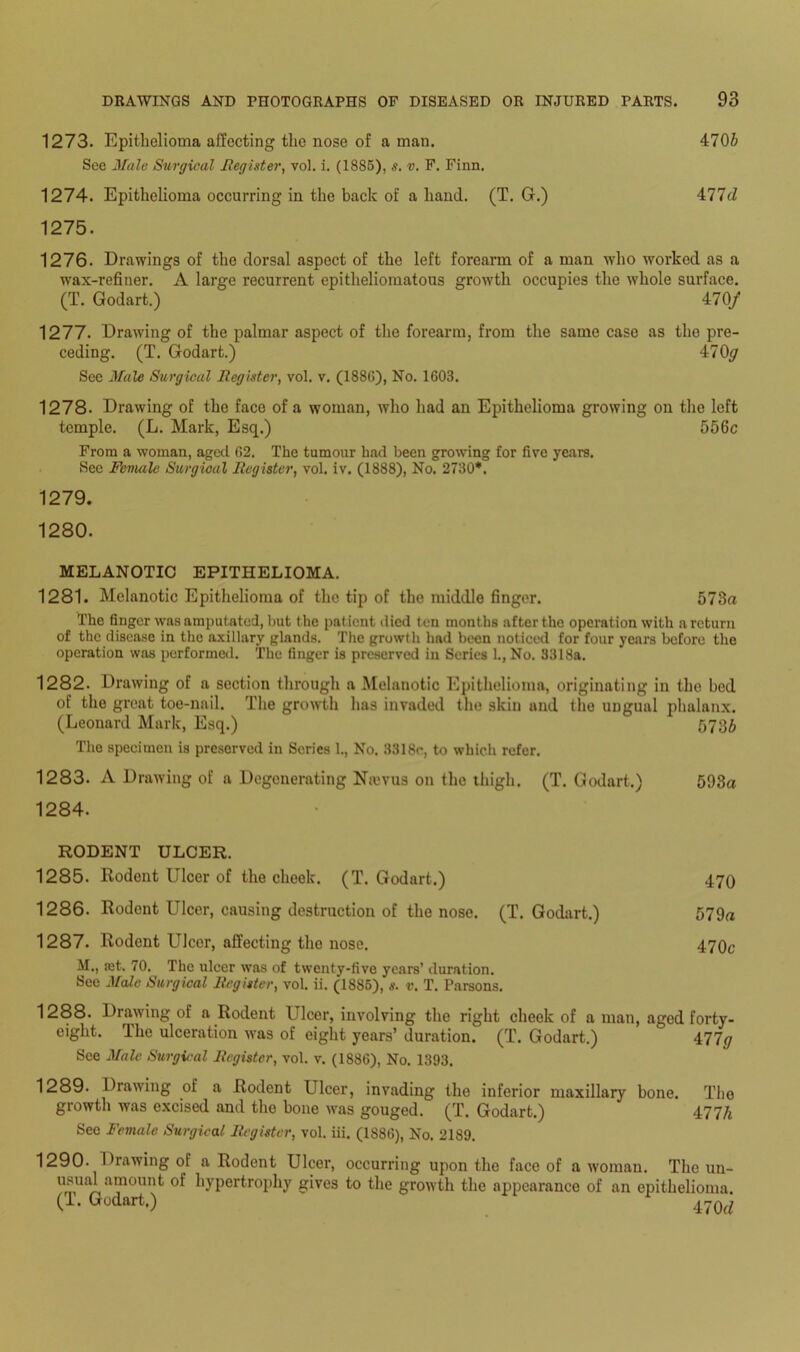 1273. Epithelioma affecting the nose of a man. 4706 See Male Surgical Register, vol. i. (1885), s. v. F. Finn. 1274. Epithelioma occurring in the back of a hand. (T. G.) 477fZ 1275. 1276. Drawings of the dorsal aspect of the left forearm of a man who worked as a wax-refiner. A large recurrent epitheliomatous growth occupies the whole surface. (T. Godart.) 470/ 1277. Drawing of the palmar aspect of the forearm, from the same caso as the pre- ceding. (T. Godart.) 470<7 See Mule Surgical Register, vol. v. (188G), No. 1608. 1278. Drawing of the face of a woman, who had an Epithelioma growing on the left temple. (L. Mark, Esq.) 556c From a woman, aged 62. The tumour had been growing for five years. See Female Surgical Register, vol. iv. (1888), No. 2730*. 1279. 1280. MELANOTIC EPITHELIOMA. 1281. Melanotic Epithelioma of the tip of the middle finger. 573a The finger was amputated, but the patient died ten months after the operation with a return of the disease in the axillary glands. The growth had been noticed for four years before the operation was performed. The finger is preserved in Series L, No. 3318a. 1282. Drawing of a section through a Melanotic Epithelioma, originating in the bed of the great toe-nail. The growth has invaded the skin and tho ungual phalanx. (Leonard Mark, Esq.) 5736 The specimen is preserved in Scries 1., No. 3318c, to which refer. 1283. A Drawing of a Degenerating Nrevus on the thigh. (T. Godart.) 593« 1284. RODENT ULCER. 1285. Rodent Ulcer of the cheek. (T. Godart.) 470 1286. Rodent Ulcer, causing destruction of the nose. (T. Godart.) 579a 1287. Rodent Ulcor, affecting tho nose. 470c M., ret. 70. The ulcer was of twenty-five years’ duration. See Male Surgical Register, vol. ii. (1885), s. v. T. Parsons. 1288. Drawing of a Rodent Ulcer, involving the right cheek of a man, aged forty- eight. The ulceration was of eight years’ duration. (T. Godart.) 477# See Male Surgical Register, vol. v. (1886), No. 1393. 1289. Drawing of a Rodent Ulcer, invading the inferior maxillary bone. The growth was excised and the hone was gouged. (T. Godart.) 477/i See Female Surgical Register, vol. iii. (1886), No. 2189. 1290- Drawing of a Rodent Ulcer, occurring upon the face of a woman. The un- u™£ a“oun^ hypertrophy gives to the growth the appearance of an epithelioma. (T. Godart.) 470(/