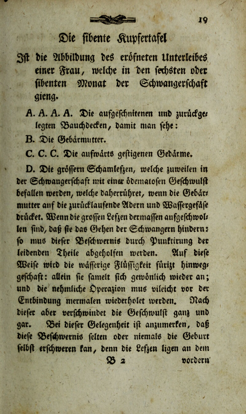 £>ie ftbetite $upfertafel Sft tic 2lM»ilt>un<j teö eröfneten Unterleiber einer grau, welche in fcen fehlten ober fibenten «0?onat t»er ©cfcroöngerfdjaft flieng. A. A. A. A. $>ie oufgcfcbnitencn mit» jurücfg« (egten SSaudjbecfen, bamit man fefye: B. Die ©ebarmutter* C. C. C. Die aufwärts gefiigenen ©ebdrme* D. Die gräffern ©djamleften, welche juweilen m ber ©djwaugerfcbaft mit einer obematofen ©efdjwulfl befallen werben, welche baf)errü()ret, wenn bie ©ebdr* mutter auf bie jurücf laufenbe 2(bern unb ffißaffetgefdfe brüefet« ©Senn bie großen ßefjen bermaffen aufgefdjwol* len ßnb, baß fte bas @el)en ber (gebwangern ^inbern: fo mus biefer SSefcbroernis bttrdj ^unftirung bet leibenben $l)eile abgefjolfen Werbern 2luf biefe ©Seife wirb bie wdfferige glüjfigfeit furijt f)wweg< gefc^aft: allein fte famelt flcft gewonlid) wiebet an; unb bie nef)m(id)e Dperajion mu$ uileicbt oot ber (Entbinbung mermalen wieberl)olet werben* 0?ad) biefer aber oerfebwinbet bie ©efdjwulß ganj unb gar* S5ei biefer ©elegenfyeit iß anjumerfen, baß biefe 33efd>wernis feiten ober niemals bie ©eburt felbjt erfrieren fan, benn bie 8ef$en (igen an bem SS 2 borberrv