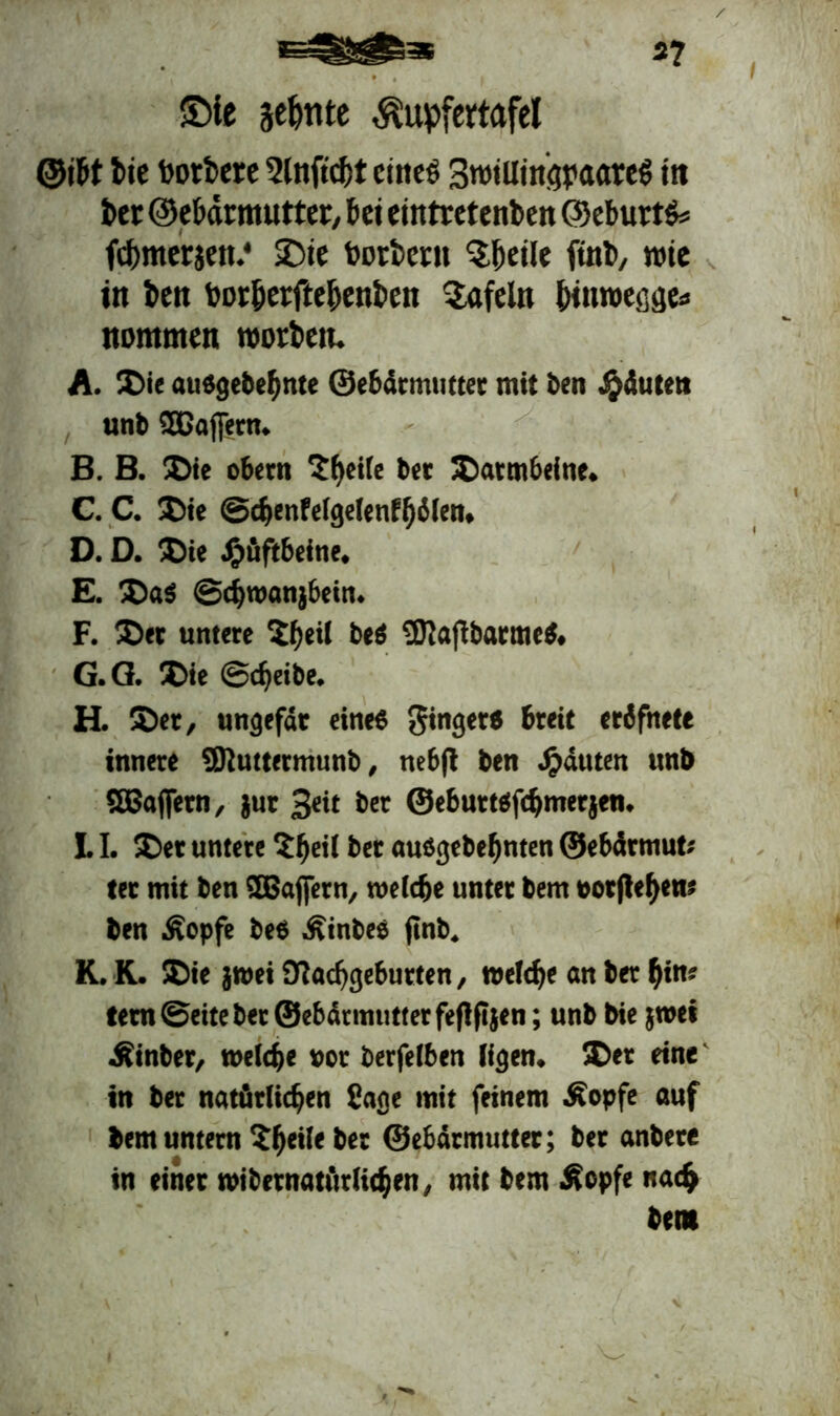 2? £)ie sehnte $upfettafel ©i&t fcte üotbere Slnftdjt ctncö BtwütngpaarcS ttt bet ©ehdrmutter, bet emtretenben ©ebutt&s fcbmetiett.* 2)ie botbcctt 'Sfjdle ftnb, wie in ben bor&erfte&enfcen tafeln hinroefige* nommen wotbett. A. $>ie außgebehttte ©ebärmutter mit ben #<Suten unb SEBajjern.. B. B. Die obern $heile bet Darmbeine. C. C. $>ie ©chenfelgelenfhölen. D. D. 5Die Hüftbeine. E. 3>aß ©djwanjbein. F. ®et untere 5he>l beß Sftafibacmeß. G. Q. IDie Scheibe. H. $>et, ungefar eine« ginger« breit erifnete innere SKuttermunb, ttebfl ben Rauten «nb SBaffetn, jur 3<it ber ©ebuttßfcljmerjen. LI. ®et untere ?be*l ber außgebebnten ©ebärmut; ter mit ben SBaffetn, welche unter bem »orftef>en? ben Äopfe be« Äinbeß finb. K. K. ®ie jraei 9Rad)gebutten, welche an ber bin* fern ©eite ber ©ebdrmutterfeflfijen; unb bie jwei Äinber, welche »or berfelben ligen. 5Der eine in ber natürlichen Sage mit feinem Äopfe auf bem untern ber ©ebdrmuttet; ber anbete in einer wibernatätlichen, mit bem Äcpfe nach bem