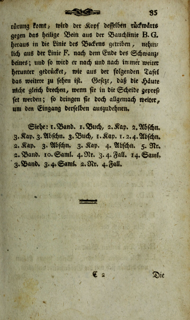 turung fomt, wirb ber ivepf beflHSfn rucfrodttß gegen b«S ^eilige $3ein aus ber 95and)linie B.G. fjetauß in bie Sinh: be$ SBecfens getriben, nefjm; lid> auS btt ßinie F. nad) bettt (Snbe bess ©djwanj? beitte»; utib fo wirb ec nad? nnb nad) immer weiter getunter gebrntfet, wie auö bet foigenben Safel baß weitere ju fefjen ifi. ©efejt, baf bie ,£<Sute nid)t g(eid) beeren, wenn fie in bie@d?eibe gepref« fet werben; fo bringen fie bod> aligemadj weiter,, um ben (Eingang berfeiben awejubefynen. ©iel)e: t.$5anb. a.Äap. s.'Jfbfdjn» 3. Äap. 3. Slbfc^n. g.fBwtfr, i.Äap. i.2,4.2fbfd>n. 2. Äap. 3» 2(bfd)n. 3. Äap. 4. 9lbfd>n. 5. 9ir. a.^Banb. 10. ©and. 4.91t. 3.4. gad. 14. ©amf. S.SBanb, 3.4* ©and. a.9?r. 4.gaß. \ . . . ,'f. I - - . ■ ,-if » v € 2 SDte 1 +