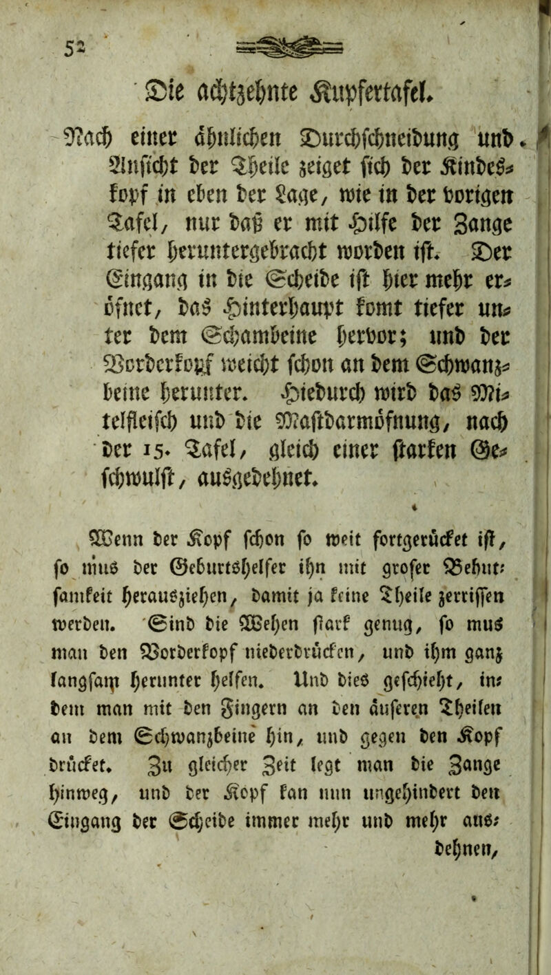 Sie adjtsehnte Äupfertafel. 9?ach eiltet dhnlichen Surchfchneibung uni). 2inftcf)t ber Qfmlc jeiget fiel) ber ÄinbeS# topf in eben ber Sage, rote in ber bongen $afcl, nur bau er mit Hilfe bet Sange tiefer heruntergebracht roorben ift. Ser (gingang in tue Scheibe ift I)ter mehr er# ofttet, baS Hinterhaupt fomt tiefer un# ter bem «Schambeine herbor; unb ber 23crbcrfopf roeicht fchott an bem Schroanj# bettte herunter. Htebuvch roirb bas $ü?i* teifieifch unb bie SOTaftbarmofnung, nach bet 15. Safel, gleich einer ftarfen @e# fchroulft, auSgebehnet. 4 50etm ter £cpf fdjon fo weit fortgetücfet tff, fo muS ter @e6urtöl)elfer tf)n mit gtofet 95efmt* famfett fjerau^iefjen, tarnte ja feine 5()eile griffen werten. @int tie SEBefyen jlatf genug, fo mu$ man ten SSorterfopf nietertruefen, unt ifym ganj fangfai\t herunter f;e(fen. Unt tie$ gefcfjteljt, im tem man mit ten gingern an ten duferen Steifen an tem 0d)n>anj6etne' (jin, unt gegen ten ^opf trüefet. 3u gleicher 3ed man tie 3an9e fynweg, unt ter Äopf fan mm ungehindert ten ©ngang ter @cf;eite immer mef)r unt mefyr aus* tet)nen.