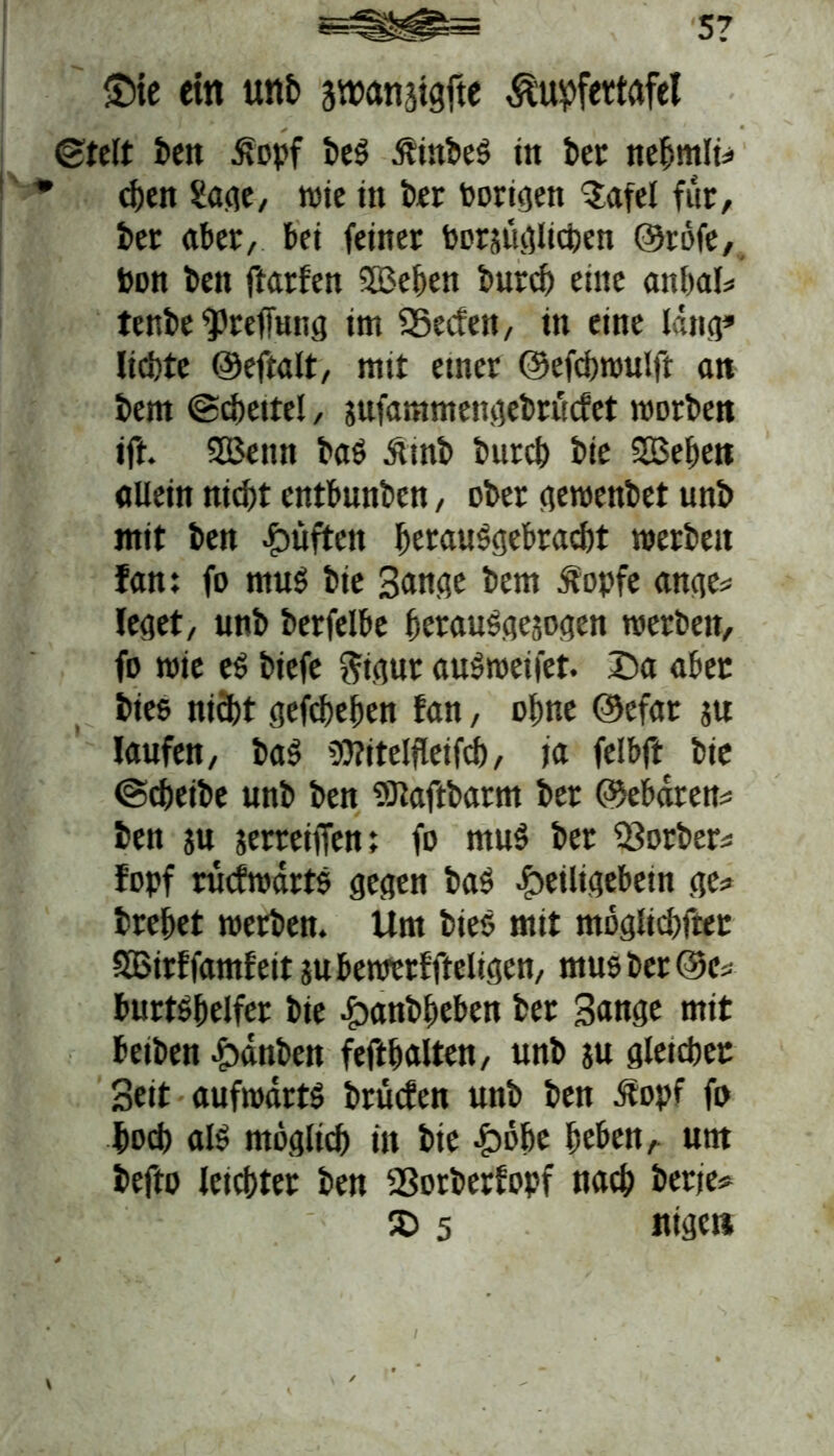 s? Sie ein unb änjanjigfte $upf<ttafel ©telt ben Äopf beS ßinbeS in bet nebmli? * d>en Safle, wie in ber hörigen $afel für, ber aber, bei feiner Porsitglicben ©röfe, hon ben ftarfen Sßeben bureb eine anbal? tenbe <pref[ung im SSecfen, in eine läng» liebte ©eftalt, mit etner ©efebwulft an bem ©cbeitel, sufammengebruefet worben ift. 2Benn bas Ämb bureb bie SBeben allein nicht entbunben, ober gewenbet unb mit ben Jpüften berausgebraebt werben fan: fo rnuS bie Bange bem dfopfe ange? leget, unb berfelbe berauSgesogen werben, fo wie eS biefe fttgur auSweifet. Da aber btes nidbt gefebeben fan, ohne ©efar su laufen, baS Witelfleifdb, ja felbfir bie «Scheibe unb ben Sftaftbarm ber ©ebären? ben su serreiffen; fo muS ber SSorber? fopf rucfwärtS gegen baS fbeiltgebetn ge? brebet werben. Um bieS mit möglichst SBitffamfeit subewerffteligen, musber@c? burtSbelfer bie £anbbeben ber Bange mit betben £>änben feftbalten, unb su gleichet Beit aufwärts brüefen unb ben dtopf fo hoch als möglich in bie £öbe beben, unt befto leichter ben SSorberfopf nach berie? 5D 5 nigeti
