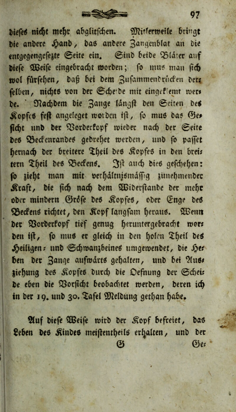 biefe* nicht mehr abatitfcf>en. SKitferwetle bringt t)ic andere Jpanb, ba$ anbere 3augenblat an bie entgegengefe&te ©eite ein, ©inb beibe 35ld:er auf biefe <SBetf€ eingebrad)t worben; fo mus man |7d> wol fürfehen, baß bei bem Sufammcnbrurfen ber*. felben, nid)t6 bon ber @che*be mit eingeflemt men be, ' 9?ad)bem bie 3an9c Wngft ben ©eiten be* Äopfeä feft angeleget wotben iß, fo mu$ ba? ©e# ftd>t unb ber QJorberfopf wieber nad) ber ©eite be$ SBecfenranbe* gebrcf>et werben, unb fo paffet hernach ber breitere £t)eil be$ ÄopfeO in ben brei; tern beö Q5e<fen$, 3ß and) bie* gefd>ef>en: fo jieht man mit t>erhdltnj*mdjfg nüne^menber Äraft, bie fleh nach bem 5Ciberftanbe ber mefjt ober minbern @r6fe be* .Kopfe*, ober (Enge be* 53ecfen* richtet, ben .Kopf langfam h«auö. ®entt ber 93orberfopf tief genug (jeruntergebraebt wer* ben iß, fo mu* er gleich in ben holen 'Ztyii be* ^eiligen? unb ©djwanjbeine* umgewenbet, bie Jper ben ber 3ange aufwärts gehalten, unb bei 9lu*j jiehung be* Kopfe* burch bie Defnung ber ©chei; be eben bie 33orßd)t beobaditet werben, beren ich in ber 19* unb 30* ^afel ^Reibung getl;an habe» 2(uf biefe 2Beife wirb ber Kopf befreiet, ba* Seben be* Kinbe* meißentheite erhalten, unb ber © ©e;