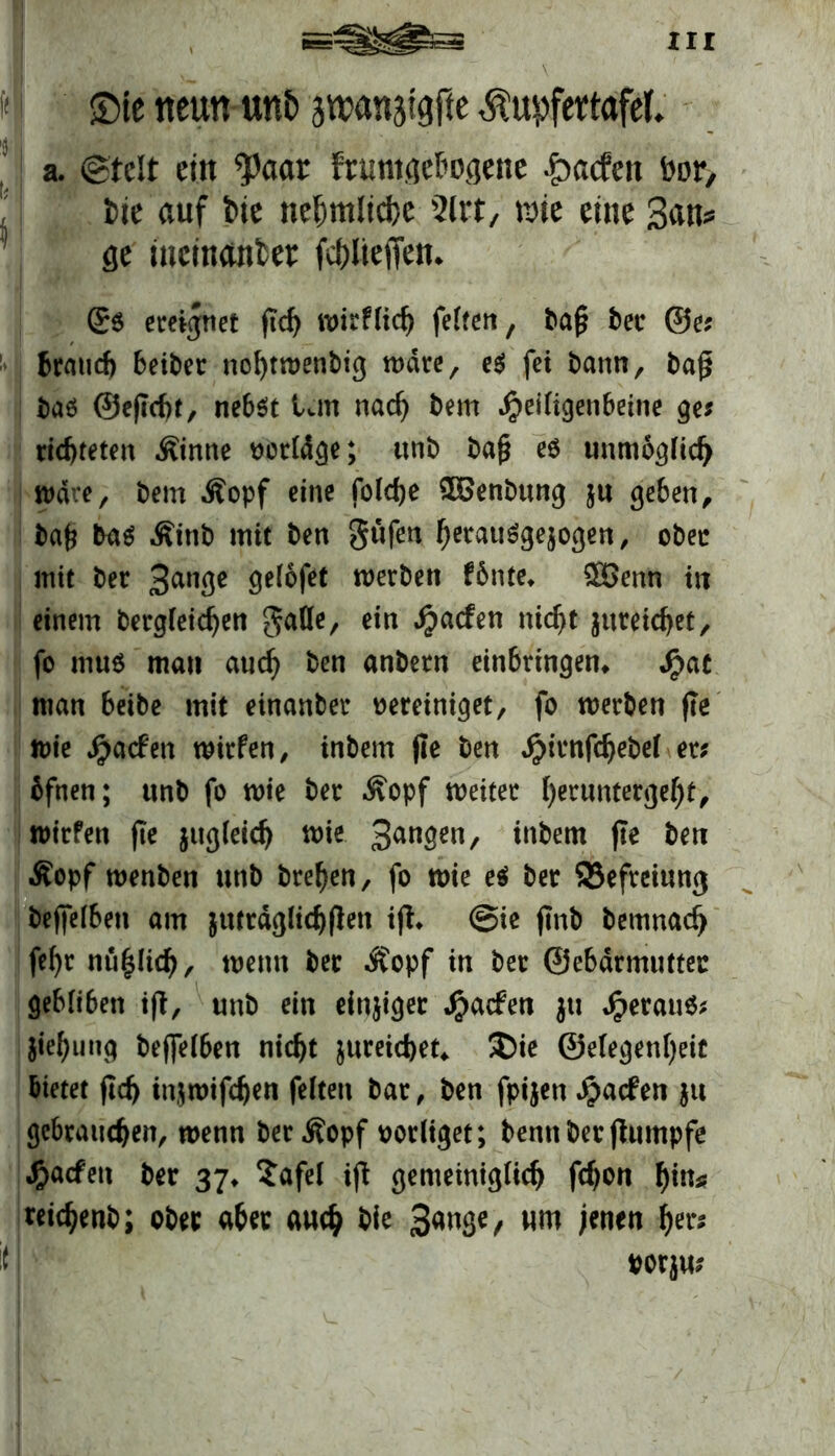 XII f'fi ©ie neun unt> airanjtgfte .tupfertafel. ij j a. @te!t eilt tyaat fruntgebogene $adm bor, ! t>ie auf Me nebmliche 2lrt, n>ie eine San? ge mettuUftef fcbltefieit* (£$ ereignet ftd) wirfUc^ feiten, ba§ bec @e; brauch beibet: nohtwenbig wäre, e$ fei bann, baß baö @e(td)t, nebst tun nad) bem Jpeiligenbeine ge# richteten .Sinne vorläge; ttnb ba£ es unmöglich wäre, bem .Sopf eine foldje 5Benbung $u geben, ba& bas .Sittb mit ben 8üfen bctauSge$ogen, ober mit ber 3an3e gelofet werben fbnte* ®enn in einem bergleidjen 5a^c/ ein nicht $ureid)et, fo mus man auch ben anbern einbringem $at man beibe mit einanber vereiniget, fo werben (Je wie Jpacfen wirfen, tnbem jie ben Jpirnfchebel er; bfnen; unb fo wie ber .Sopf weiter ()eruntergef)t, wirfen jte zugleich wie 3an3en/ inbem jte ben Äopf wenben unb bre^en, fo wie e$ ber Befreiung beffelbett am juträglichjlen ifh @ie jmb bemnad) fef)r nu^lid), wenn ber $opf in ber ©ebdrmuttec öebliben ift, unb ein einjiger Jjjacfen jti £erau$; Jie^ung beffelben nicht jureichet* 5Die ©e(egenl)eit bietet (Id) injwifdjen feiten bar, ben fpijen £a<f en $u gebrauchen, wenn berÄopf vorliget; bennber jtumpfe J&acfeu ber 37* Safel ijt gemeiniglich fdjon bim? reichenb; ober aber auch bie 3<mge, um jenen tyv if vorju;