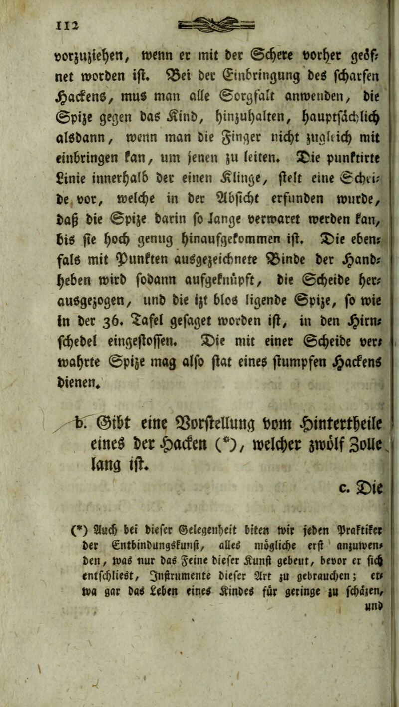 porjujtefyen, wenn ec mit ber ©djete normet ge5f? net worben ijh 93et bec Einbringung be$ fdjarfen Härtens, mu$ man alle Sorgfalt anwenben, bie ©pije gegen bas Ätnb, fyinjufyalten, (jauptfäcHidj aisbann, wenn man bie ginger nicfyt jugleid) mit einbringen fan, um jenen ju (eiten* Die punftirte £inie innerhalb ber einen klinge, fielt eine ©d)ti; be vor, welche in ber $lb|1d)t erfunben würbe, baf bie @pt$e barin fo lange perwaret werben fan, bis fte l)od) genug fyinaufgefommen iji, Die e6em fate mit fünften ausgezeichnete ®inbe ber Jpanb* tyeben wirb fobann aufgefnüpft, bie ©treibe f)et; ausgewogen, unb bie ijt Mos ligenbe ©pi^e, fo wie in ber 36* Safel gefaget worben ifl, in ben $irn; fdjebel eingejlojfen. Die mit einer ©djeibe per; wahrte ©pije mag alfo flat eines Rümpfen JjjacfenS bienen* iC ©iH etne SSorfleUunfl Dom Hinterteile eined beriefen O, welcher jwolfSolle, lang ifh c. Die (*) Slucb bei biefer ©elegenfjeit beten tuir jeben <PraFtifer ber €ntbinbung$Funjt, alles mögliche er# anjutven* beit, K>öS nur bßS Seine biefer Äunft gebeut, becor er ftc^ entfc^lieSt, 3nftnimente biefer 2lrt a« gebrauten; tu tv« gar DöS £ebeit eines ÄinbeS für geringe au fcfrfljen, unb