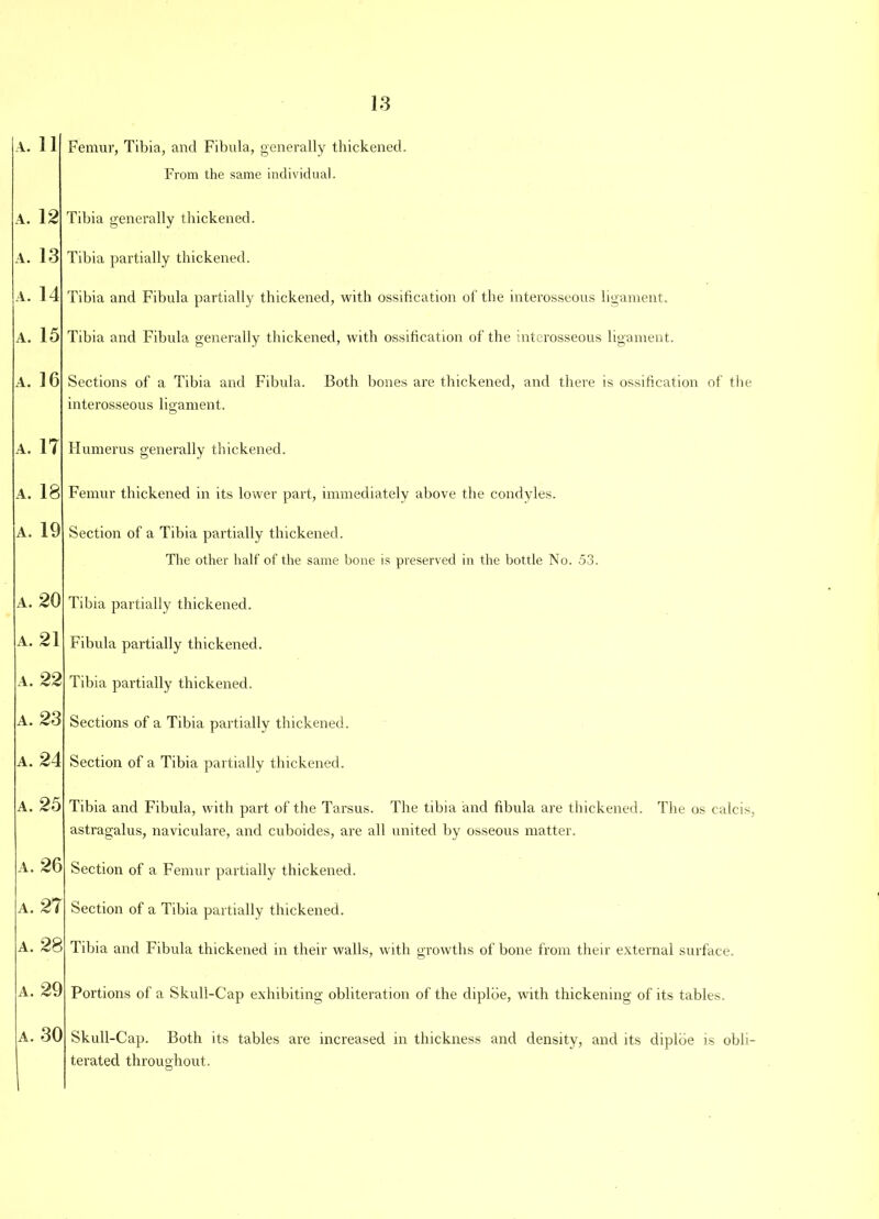 A. 1 1 Femur, Tibia, and Fibula, generally thickened. From the same individual. A. 12 A. 13 A. 14 A. 15 A. 16 A. 17 A. 18 A. 19 A. 20 A. 21 a. 22 a. 23 A. 24 Tibia generally thickened. Tibia partially thickened. Tibia and Fibida partially thickened, with ossification of the interosseous ligament. Tibia and Fibula generally thickened, with ossification of the interosseous ligament. Sections of a Tibia and Fibula. Both bones ai’e thickened, and there is ossification of the interosseous ligament. Humerus generally thickened. Femur thickened in its lower part, immediately above the condyles. Section of a Tibia partially thickened. The other half of the same bone is preserved in the bottle No. 53. Tibia partially thickened. Fibula partially thickened. Tibia partially thickened. Sections of a Tibia partially thickened. Section of a Tibia partially thickened. a. 25 Tibia and Fibula, with part of the Tarsus. The tibia and fibula are thickened, astragalus, naviculare, and cuboides, are all united by osseous matter. The os calcis, A. 26 Section of a Femur partially thickened. A. 2 i Section of a Tibia partially thickened. a. 28 Tibia and Fibula thickened in their walls, with growths of bone from their external surface. a. 29 Portions of a Skull-Cap exhibiting obliteration of the diploe, with thickening of its tables. a. 30 Skull-Cap. Both its tables are increased in thickness and density, and its diploe is obli- terated throughout.