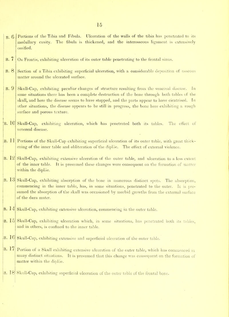 I g fj Portions of the Tibia and Fibula. Ulceration of the walls of the tibia has penetrated to its medullary cavity. The fibula is thickened, and the interosseous ligament is extensively ossified. B. 7 Os Frontis, exhibiting ulceration of its outer table penetrating to the frontal sinus. | B. 8 i B. 9 B. 10 B. 11 B. 12 B. 14 B. 15 ; .8. 10 !b. 17 |b. 18 Section of a Tibia exhibiting superficial ulceration, with a considerable deposition of osseous matter around the ulcerated surface. Skull-Cap, exhibiting peculiar changes of structure resulting from the venereal disease. In some situations there has been a complete destruction of the bone through both tables of the skull, and here the disease seems to have stopped, and the parts appear to have cicatrised. In other situations, the disease appears to be still in progress, the bone here exhibiting a rough surface and porous texture. Skull-Cap, exhibiting ulceration, which has penetrated both its tables. The effect of venereal disease. Portions of the Skull-Cap exhibiting superficial ulceration of its outer table, with great thick- ening of the inner table and obliteration of the diplbe. The effect of external violence. Skull-Cap, exhibiting extensive ulceration of the outer table, and ulceration to a less extent of the inner table. It is presumed these changes were consequent on the formation of matter within the diplbe. Skull-Cap, exhibiting absorption of the bone in numerous distinct spots. The absorption, commencing in the inner table, has, in some situations, penetrated to the outer. It is pre- sumed the absorption of the skull was occasioned by morbid growths from the external surface of the dura mater. Skull-Cap, exhibiting extensive ulceration, commencing in the outer table. Skull-Cap, exhibiting ulceration which, in some situations, has penetrated both its tables, and in others, is confined to the inner table. Skull-Cap, exhibiting extensive and superficial ulceration of the outer table. Portion of a Skull exhibiting extensive ulceration of the outer table, which has commenced in many distinct situations. It is presumed that this change was consequent on the formation of matter within the diplbe. Skull-Cap, exhibiting superficial ulceration of the outer table of the frontal bone.
