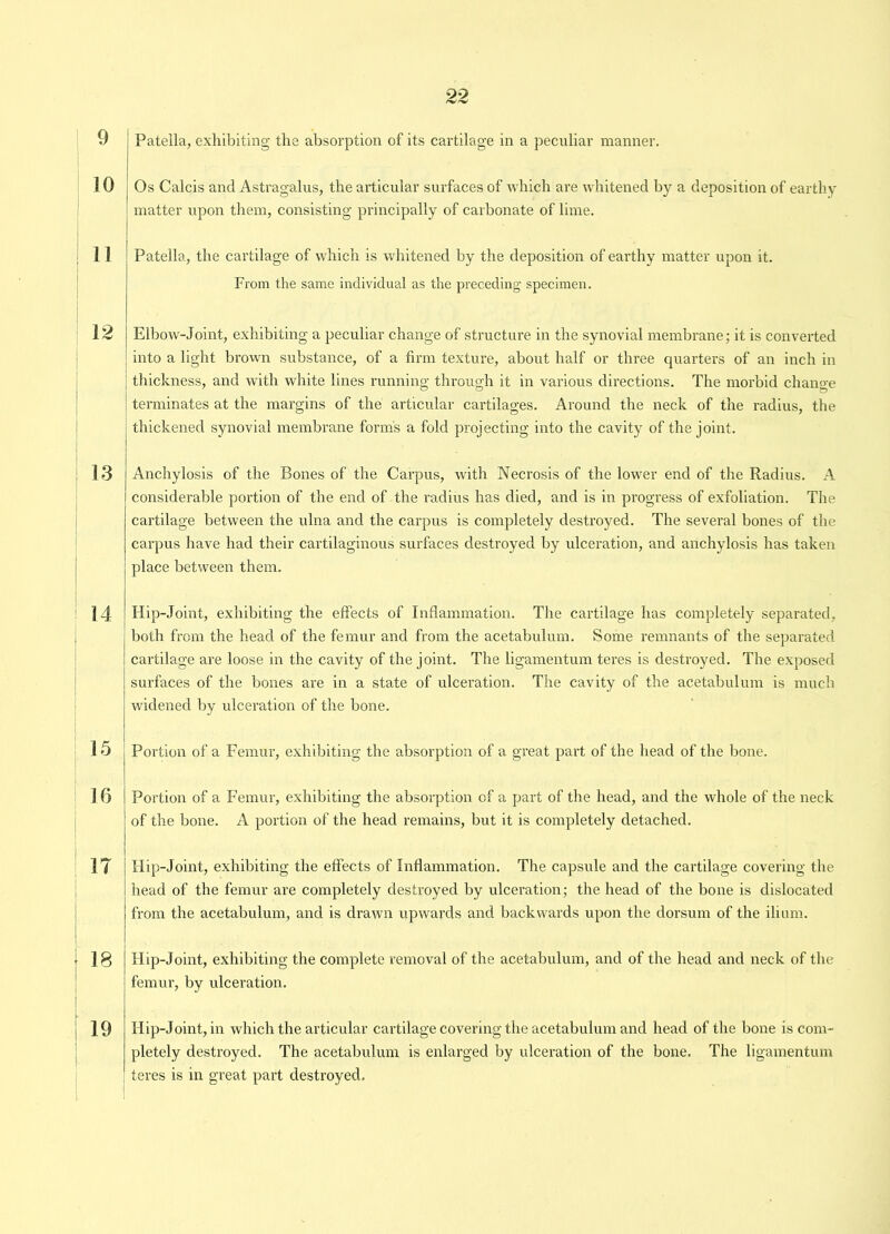 9 ]0 11 12 1.3 14 15 16 IT 18 19 22 Patella, exhibiting the absorption of its cartilage in a peculiar manner. Os Calcis and Astragalus, the articular surfaces of which are whitened by a deposition of earthy matter upon them, consisting principally of carbonate of lime. Patella, the cartilage of which is whitened by the deposition of earthy matter upon it. From the same individual as the preceding specimen. Elbow-Joint, exhibiting a peculiar change of structure in the synovial membrane; it is converted into a light brown substance, of a firm texture, about half or three quarters of an inch in thickness, and with white lines running through it in various directions. The morbid change terminates at the margins of the articular cartilages. Around the neck of the radius, the thickened synovial membrane forms a fold projecting into the cavity of the joint. Anchylosis of the Bones of the Carpus, with Necrosis of the lower end of the Radius. A considerable portion of the end of the radius has died, and is in progress of exfoliation. The cartilage between the ulna and the carpus is completely destroyed. The several bones of the carpus have had their cartilaginous surfaces destroyed by ulceration, and anchylosis has taken place between them. Hip-Joint, exhibiting the effects of Inflammation. The cartilage has completely separated, both from the head of the femur and from the acetabulum. Some remnants of the separated cartilage are loose in the cavity of the joint. The ligamentum teres is destroyed. The exposed surfaces of the bones are in a state of ulceration. The cavity of the acetabulum is much widened by ulceration of the bone. Portion of a Femur, exhibiting the absorption of a great part of the head of the bone. Portion of a Femur, exhibiting the absorption of a part of the head, and the whole of the neck of the bone. A portion of the head remains, but it is completely detached. Hip-Joint, exhibiting the effects of Inflammation. The capsule and the cartilage covering the head of the femur are completely destroyed by ulceration; the head of the bone is dislocated from the acetabulum, and is drawn upwards and backwards upon the dorsum of the ilium. Hip-Joint, exhibiting the complete removal of the acetabulum, and of the head and neck of the femur, by ulceration. Hip-Joint, in which the articular cartilage covering the acetabulum and head of the bone is com- pletely destroyed. The acetabulum is enlarged by ulceration of the bone. The ligamentum teres is in great part destroyed.