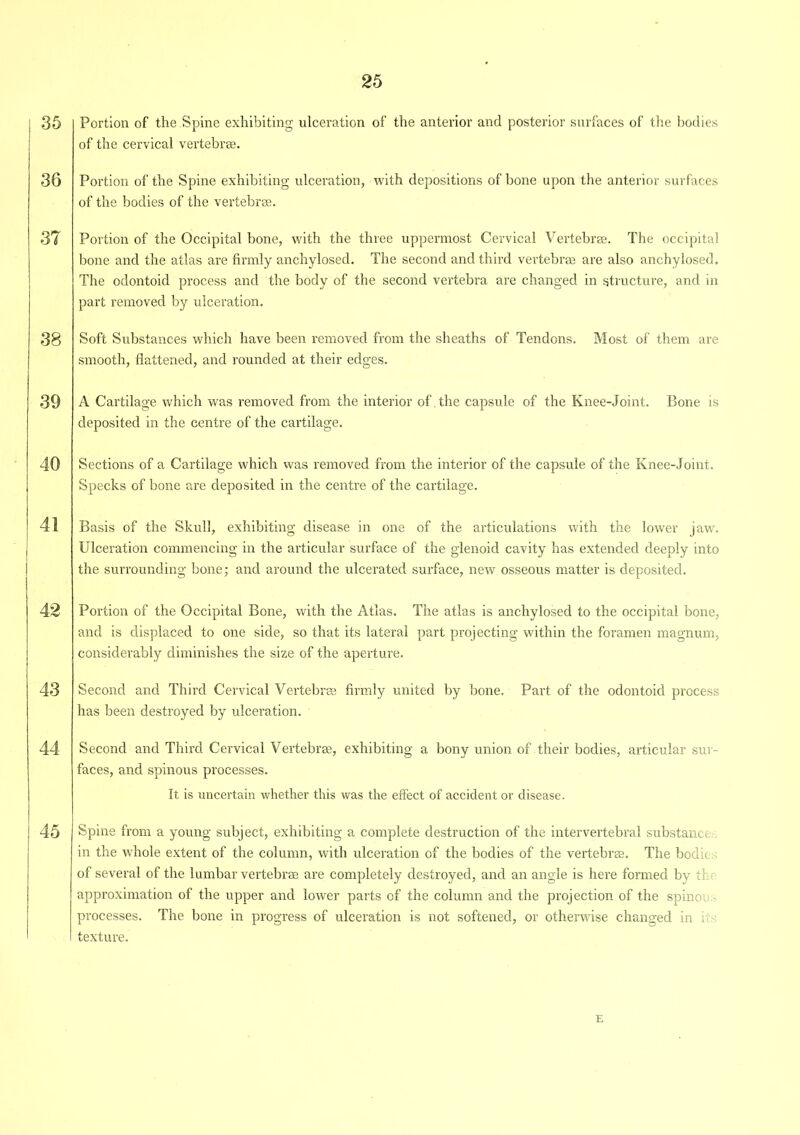 35 Portion of the Spine exhibiting ulceration of the anterior and posterior surfaces of the bodies of the cervical vertebra. 36 37 38 39 40 41 42 43 44 45 Portion of the Spine exhibiting ulceration, with depositions of bone upon the anterior surfaces of the bodies of the vertebrae. Portion of the Occipital bone, with the three uppermost Cervical Vertebrae. The occipital bone and the atlas ai’e firmly anchylosed. The second and third vertebrae are also anchylosed. The odontoid process and the body of the second vertebra are changed in structure, and in part removed by ulceration. Soft Substances which have been removed from the sheaths of Tendons. Most of them are smooth, flattened, and rounded at their edges. A Cartilage which was removed from the interior of , the capsule of the Knee-Joint. Bone is deposited in the centre of the cartilage. Sections of a Cartilage which was removed from the interior of the capsule of the Knee-Joint. Specks of bone are deposited in the centre of the cartilage. Basis of the Skull, exhibiting disease in one of the articulations with the lower jaw. Ulceration commencing in the articular surface of the glenoid cavity has extended deeply into the surrounding bone; and around the ulcerated surface, new osseous matter is deposited. Portion of the Occipital Bone, with the Atlas. The atlas is anchylosed to the occipital bone, and is displaced to one side, so that its lateral part projecting within the foramen magnum, considerably diminishes the size of the aperture. Second and Third Cervical Vertebra firmly united by bone. Part of the odontoid process has been destroyed by ulceration. Second and Third Cervical Vertebrae, exhibiting a bony union of their bodies, articular sur- faces, and spinous processes. It is uncertain whether this was the effect of accident or disease. Spine from a young subject, exhibiting a complete destruction of the intervertebral substance in the whole extent of the column, with ulceration of the bodies of the vertebras. The bodk of several of the lumbar vertebrae are completely destroyed, and an angle is here formed by th approximation of the upper and lower parts of the column and the projection of the spinor processes. The bone in progress of ulceration is not softened, or otherwise changed in ; texture. E