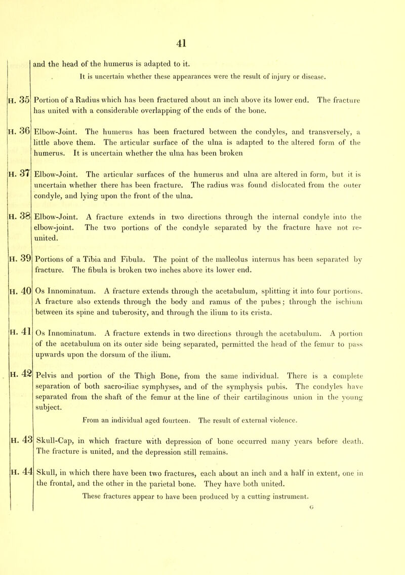 h. 35 h. 36 h. 37 h. 38 h. 39 h. 40 h. 41 h. 42 h. 43 h. 44 and the head of the humerus is adapted to it. It is uncertain whether these appearances were the result of injury or disease. Portion of a Radius which lias been fractured about an inch above its lower end. The fracture has united with a considerable overlapping of the ends of the bone. Elbow-Joint. The humerus has been fractured between the condyles, and transversely, a little above them. The articular surface of the ulna is adapted to the altered form of the humerus. It is uncertain whether the ulna has been broken Elbow-Joint. The articular surfaces of the humerus and ulna are altered in form, but it is uncertain whether there has been fracture. The radius was found dislocated from the outer condyle, and lying upon the front of the ulna. Elbow-Joint. A fracture extends in two directions through the internal condyle into the elbow-joint. The two portions of the condyle separated by the fracture have not re- united. Portions of a Tibia and Fibula. The point of the malleolus interims has been separated by fracture. The fibula is broken two inches above its lower end. Os Innominatum. A fracture extends through the acetabulum, splitting it into four portions. A fracture also extends through the body and ramus of the pubes; through the ischium between its spine and tuberosity, and through the ilium to its crista. Os Innominatum. A fracture extends in two directions through the acetabulum. A portion of the acetabulum on its outer side being separated, permitted the head of the femur to pass upwards upon the dorsum of the ilium. Pelvis and portion of the Thigh Bone, from the same individual. There is a complete separation of both sacro-iliac symphyses, and of the symphysis pubis. The condyles have separated from the shaft of the femur at the line of their cartilaginous union in the young subject. From an individual aged fourteen. The result of external violence. Skull-Cap, in which fracture with depression of bone occurred many years before death. The fracture is united, and the depression still remains. Skull, in which there have been two fractures, each about an inch and a half in extent, one in the frontal, and the other in the parietal bone. They have both united. These fractures appear to have been produced by a cutting instrument. G
