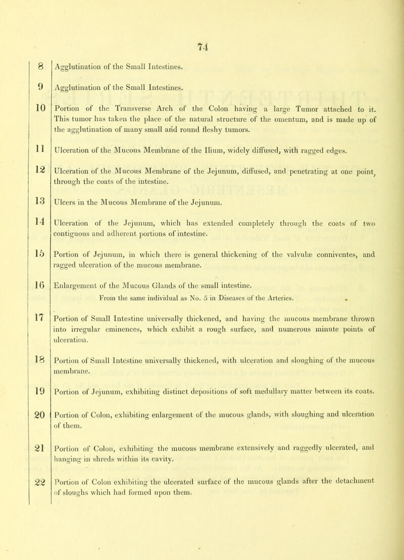 9 10 11 12 13 14 15 16 IT 18 19 T4 Agglutination of the Small Intestines. Portion of the Transverse Arch of the Colon having a large Tumor attached to it. This tumor has taken the place of the natural structure of the omentum, and is made up of the agglutination of many small arid round fleshy tumors. Ulcei’ation of the Mucous Membrane of the Ilium, widely diffused, with ragged edges. Ulceration of the Mucous Membrane of the Jejunum, diffused, and penetrating at one point, through the coats of the intestine. Ulcers in the Mucous Membrane of the Jejunum. Ulceration of the Jejunum, which has extended completely through the coats of two contiguous and adherent portions of intestine. Portion of Jejunum, in which there is general thickening of the valvulse conniventes, and ragged ulceration of the mucous membrane. Enlargement of the Mucous Glands of the small intestine. From the same individual as No. 5 in Diseases of the Arteries. Portion of Small Intestine universally thickened, and having the mucous membrane thrown into irregular eminences, which exhibit a rough surface, and numerous minute points of ulceration. Portion of Small Intestine universally thickened, with ulceration and sloughing of the mucous membrane. Portion of Jejunum, exhibiting distinct depositions of soft medullary matter between its coats. 20 Portion of Colon, exhibiting enlargement of the mucous glands, with sloughing and ulceration of them. 21 Portion of Colon, exhibiting the mucous membrane extensively and raggedly ulcerated, and hanging in shreds within its cavity. 22 Portion of Colon exhibiting the ulcerated surface of the mucous glands after the detachment of sloughs which had formed upon them.
