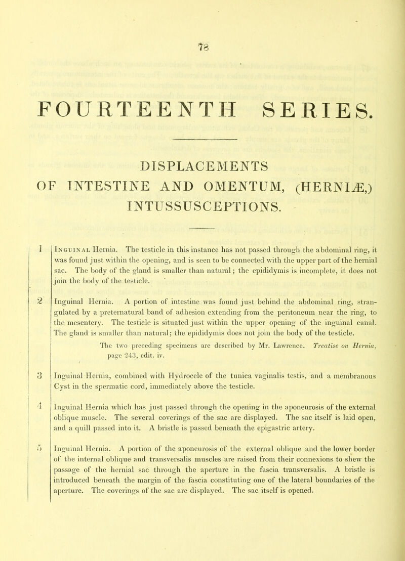 FOURTEENTH SERIES. DISPLACEMENTS OF INTESTINE AND OMENTUM, (HERNI2E,) INTUSSUSCEPTIONS. 1 Inguinal Hernia. The testicle in this instance has not passed through the abdominal ring, it was found just within the opening, and is seen to be connected with the upper part of the hernial sac. The body of the gland is smaller than natural; the epididymis is incomplete, it does not join the body of the testicle. 2 Inguinal Hernia. A portion of intestine was found just behind the abdominal ring, stran- gulated by a preternatural band of adhesion extending from the peritoneum near the ring, to the mesentery. The testicle is situated just within the upper opening of the inguinal canal. The gland is smaller than natural; the epididymis does not join the body of the testicle. The two preceding specimens are described by Mr. Lawrence. Treatise on Hernia, page 243, edit. iv. 3 Inguinal Hernia, combined with Hydrocele of the tunica vaginalis testis, and a membranous Cyst in the spermatic cord, immediately above the testicle. 4 Inguinal Hernia which has just passed through the opening in the aponeurosis of the external oblique muscle. The several coverings of the sac are displayed. The sac itself is laid open, and a quill passed into it. A bristle is passed beneath the epigastric artery. 5 Inguinal Hernia. A portion of the aponeurosis of the external oblique and the lower border of the internal oblique and transversalis muscles are raised from their connexions to shew the passage of the hernial sac through the aperture in the fascia transversalis. A bristle is introduced beneath the margin of the fascia constituting one of the lateral boundaries of the aperture. The coverings of the sac are displayed. The sac itself is opened.