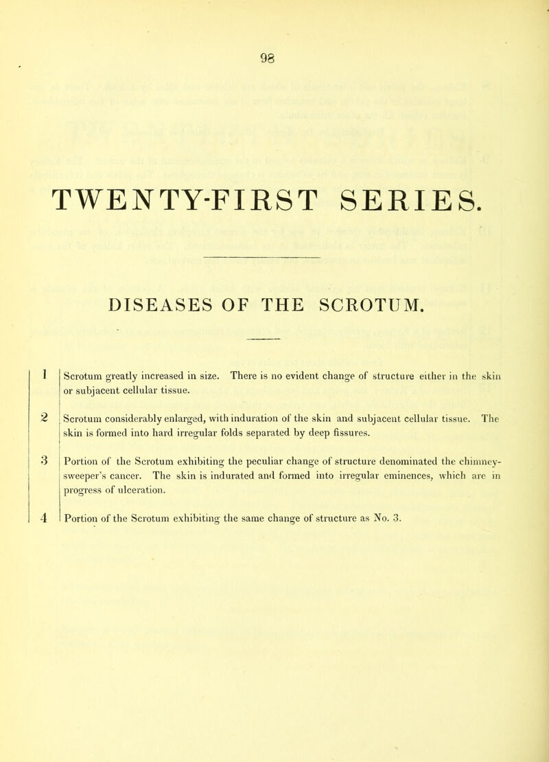 TWENTY-FIRST SERIES. DISEASES OF THE SCROTUM. 1 Scrotum greatly increased in size. There is no evident change of structure either in the skin or subjacent cellular tissue. 2 Scrotum considerably enlarged, with induration of the skin and subjacent cellular tissue. The skin is formed into hard irregular folds separated by deep fissures. 3 i Portion of the Scrotum exhibiting the peculiar change of structure denominated the chimney- sweeper’s cancer. The skin is indurated and formed into irregular eminences, which are in progress of ulceration. 4 Portion of the Scrotum exhibiting the same change of structure as No. 3.