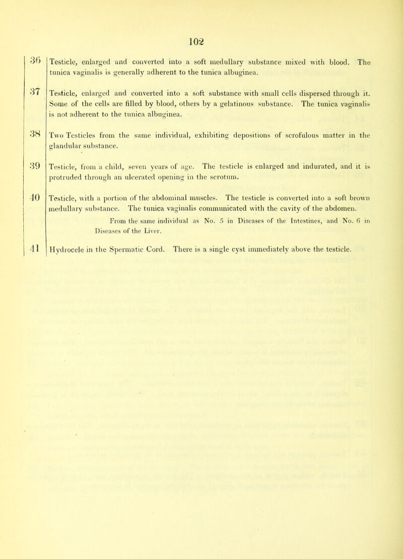 •10 Testicle, enlarged and converted into a soft medullary substance mixed with blood. The tunica vaginalis is generally adherent to the tunica albuginea. •11 Testicle, enlarged and converted into a soft substance with small cells dispersed through it. Some of the cells are filled by blood, others by a gelatinous substance. The tunica vaginalis is not adherent to the tunica albuginea. ■38 Two Testicles from the same individual, exhibiting depositions of scrofulous matter in the glandular substance. 39 Testicle, from a child, seven years of age. The testicle is enlarged and indurated, and it is protruded through an ulcerated opening in the scrotum. 40 Testicle, with a portion of the abdominal muscles. The testicle is converted into a soft brown medullary substance. The tunica vaginalis communicated with the cavity of the abdomen. From the same individual as No. 5 in Diseases of the Intestines, and No. 6 in Diseases of the Liver. 41 Hydrocele in the Spermatic Cord. There is a single cyst immediately above the testicle.