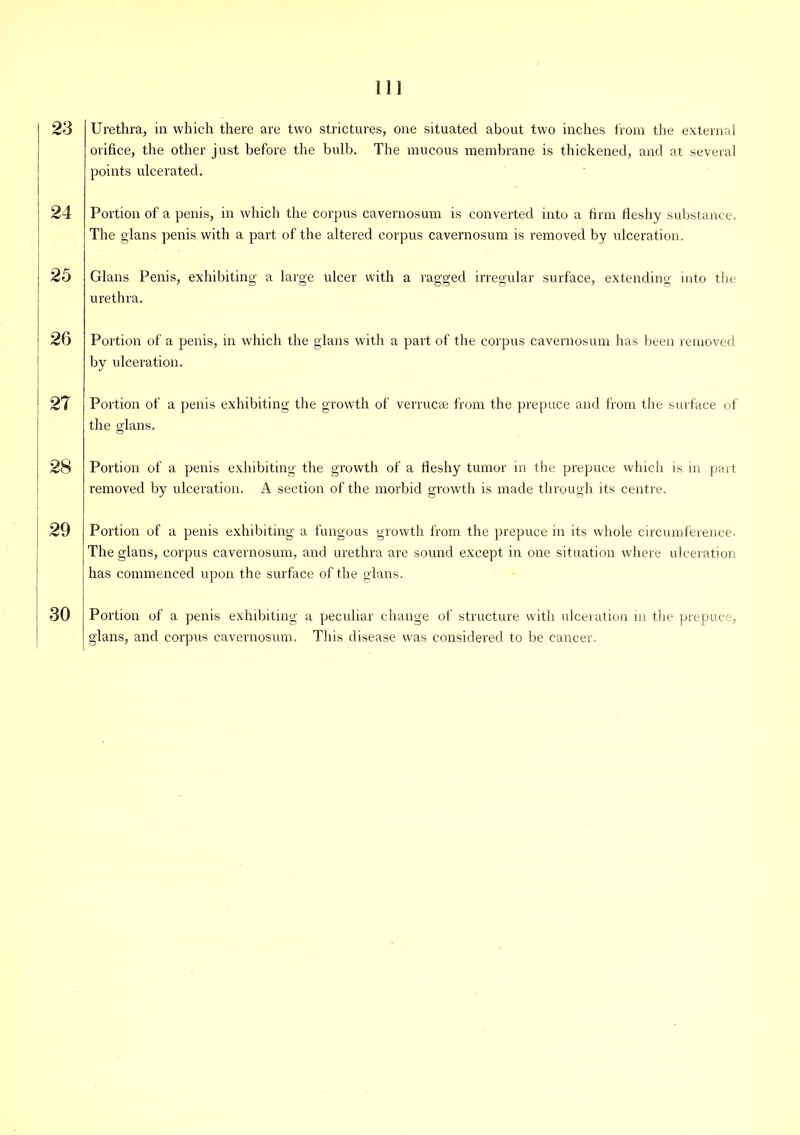 ns 23 Urethra, in which there are two strictures, one situated about two inches from the external orifice, the other just before the bulb. The mucous membrane is thickened, and at several points ulcerated. 24 Portion of a penis, in which the corpus cavernosum is converted into a firm fieshy substance. The glans penis with a part of the altered corpus cavernosum is removed by ulceration. 25 Gians Penis, exhibiting a large ulcer with a ragged irregular surface, extending into the urethra. 26 Portion of a penis, in which the glans with a part of the corpus cavernosum has been removed by ulceration. 27 Portion of a penis exhibiting the growth of verrucse from the prepuce and from the surface of the glans. 28 Portion of a penis exhibiting the growth of a fieshy tumor in the prepuce which is m part removed by ulceration. A section of the morbid growth is made through its centre. 29 Portion of a penis exhibiting a fungous growth from the prepuce in its whole circumference. The glans, corpus cavernosum, and urethra are sound except in one situation where ulceration has commenced upon the surface of the glans. 30 Portion of a penis exhibiting a peculiar change of structure with ulceration in the prepuce, glans, and corpus cavernosum. This disease was considered to be cancer.