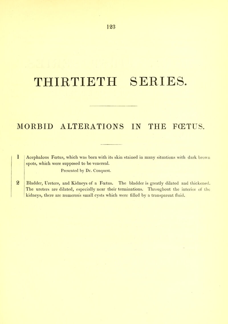 THIRTIETH SERIES. MORBID ALTERATIONS IN THE F<ETUS. 1 Acephalous Foetus, which was bom with its skin stained in many situations with dark brown spots, which were supposed to be venereal. Presented by Dr. Conquest. 2 Bladder, Ureters, and Kidneys of a Foetus. The bladder is greatly dilated and thickened. The ureters are dilated, especially near their terminations. Throughout the interior of the kidneys, there are numerous small cysts which wrere filled by a transparent fluid.