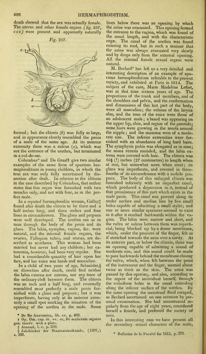 death shewed that the sex was actually female. The uterus and other female organs (fig. 287, cccj were present and apparently naturally Fig. 287. formed ; but the clitoris (b) was fully as large, and in appearance closely resembled the penis of a male of the same age. At its anterior extremity there was a sulcus («), which was not the entrance of the urethra, but terminated in a cul-de-sac. Columbus* * * § and De Graaff give two similar examples of the same form of spurious her- maphroditism in young children, in which the true sex was only fully ascertained by dis- section after deah. In relation to the clitoris in the case described by Columbus, that author states that this organ was furnished with two muscles only, and not with four, as in the per- fect male. In a reputed hermaphrodite woman, GallayJ found after death the clitoris to be three and a half inches long, and three inches and four lines in circumference. The glans and prepuce were well developed. The urethra ran as in man through the body of the penis and its glans. The labia, nymphse, vagina, &c. were natural, and the internal female organs, the ovaries, Fallopian tubes, and uterus, are de- scribed as scirrhous. This woman had been married but never had any children; her ca- tamenia, however, had been very regular. She had a considerable quantity of hair upon her face, and her voice was harsh and masculine. In a child of two years of age, Schneider,§ on dissection after death, could find neither the labia externa nor interna, nor any trace of the ordinary cleft between them. The clitoris was an inch and a half long, and externally resembled most perfectly a male penis fur- nished with a glans and prepuce; but it was imperforate, having only at its anterior extre- mity a small spot marking the situation of the opening of the urethra in the male. Some * De Re Anatomica, lib. xv, p. 493. f Op. Om. cap. iii. xv. or, De mulierum organis gen. inserv. wiih a plate. t Arnaud, 1. c. p. 309. § Jahrbucher der Staatsarzncikunde, (1809,) s. 193. lines below there was an opening by which the urine was evacuated. This opening formed the entrance to the vagina, which was found of the usual length, aud with the characteristic rugae. The canal of the urethra was found entering its roof, but in such a manner that the urine was always evacuated very slowly and by drops only from the external opening. All the internal female sexual organs were natural. M. Beclard* has left us a very detailed and interesting description of an example of spu- rious hermaphroditism referable to the present variety, and exhibited at Paris in 1814. The subject of the case, Marie Madeline Lefort, was at that time sixteen years of age. The proportions of the trunk and members, and of the shoulders and pelvis, and the conformation and dimensions of this last part of the body, were all masculine; the volume of the larynx also, and the tone of the voice were those of an adolescent male ; a beard was appearing on the upper lip, chin, and region of the parotids; some hairs were growing in the areola around the nipple; and the mammae were of a mode- rate size. The inferior extremities were fur- nished with an abundance of long hard hairs. The symphysis pubis was elongated as in man; the mons veneris rounded, and the labia ex- terna were covered with hair. The clitoris was 10J (?) inches (27 centimetres) in length when at rest, but somewhat more when erect; its glans was imperforate, and covered in three- fourths of its circumference with a mobile pre- puce. The body of this enlarged clitoris was furnished inferiorly with an imperfect canal, which produced a depression in it, instead of that prominence of this part which exists in the male penis. This canal was pierced along its under surface and median line by five small holes capable of admitting a small stylet; and one or more similar apertures seemed to exist in it after it reached backwards within the va- gina. The labia were narrow and short, and the vulva or sulcus between them was superfi- cial, being blocked up by a dense membrane, which, under the pressure of the finger, felt as if stretched towards the anus over a cavity. At its anterior part, or below the clitoris, there was an opening capable of admitting a sound of moderate size, and this sound could be made to pass backwards behind the membrane closing the vulva, which, when felt between the point of the instrument and the finger, seemed about twice as thick as the skin. The urine was passed by this opening, and also, according to the report of the individual herself, through the cribriform holes in the canal extending along the inferior surface of the urethra. By the same opening the menstrual fluid escaped, as Beclard ascertained on one occasion by per- sonal examination. She had menstruated re- gularly from the age of eight years, considered herself a female, and preferred the society of men. In this interesting case we have present all the secondary sexual characters of the male, * Bulletins de la Faculte for 1815, p. 273.