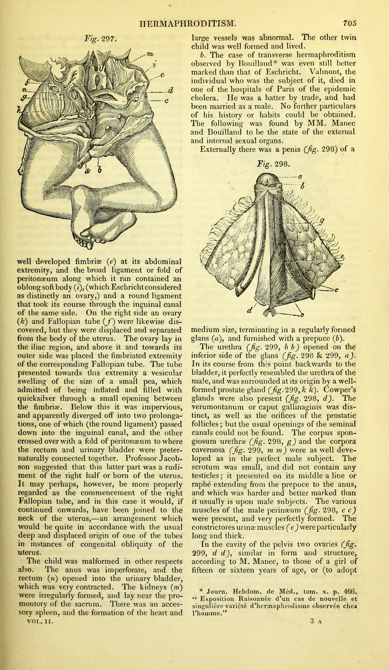 Fig. 297. well developed fimbria (e) at its abdominal extremity, and the broad ligament or fold of peritonaeum along which it ran contained an oblong soft body (i), (which Eschrichtconsidered as distinctly an ovary,) and a round ligament that took its course through the inguinal canal of the same side. On the right side an ovary (k) and Fallopian tube (J‘) were likewise dis- covered, but they were displaced and separated from the body of the uterus. The ovary lay in the iliac region, and above it and towards its outer side was placed the fimbriated extremity of the corresponding Fallopian tube. The tube presented towards this extremity a vesicular swelling of the size of a small pea, which admitted of being inflated and filled with quicksilver through a small opening between the fimbriae. Below this it was impervious, and apparently diverged off into two prolonga- tions, one of which (the round ligament) passed down into the inguinal canal, and the other crossed over with a fold of peritonaeum to where the rectum and urinary bladder were preter- naturally connected together. Professor Jacob- son suggested that this latter part was a rudi- ment of the right half or horn of the uterus. It may perhaps, however, be more properly regarded as the commencement of the right Fallopian tube, and in this case it would, if continued onwards, have been joined to the neck of the uterus,—an arrangement which would be quite in accordance with the usual deep and displaced origin of one of the tubes in instances of congenital obliquity of the uterus. The child was malformed in other respects also. The anus was imperforate, and the rectum (n) opened into the urinary bladder, which was very contracted. The kidneys (in) were irregularly formed, and lay near the pro- montory of the sacrum. There was an acces- sory spleen, and the formation of the heart and large vessels was abnormal. The other twin child was well formed and lived. b. The case of transverse, hermaphroditism observed by Bouillaud* was even still better marked than that of Eschricht. Valmont, the individual who was the subject of it, died in one of the hospitals of Paris of the epidemic cholera. He was a hatter by trade, and had been married as a male. No further particulars of his history or habits could be obtained. The following was found by MM. Manec and Bouillaud to be the state of the external and internal sexual organs. Externally there was a penis (Jig. 298) of a Fig. 298. medium size, terminating in a regularly formed glans (a), and furnished with a prepuce (6). The urethra (Jig. 299, b b) opened on the inferior side of the glans (Jig. 298 & 299, a). In its course from th;s point backwards to the bladder, it perfectly resembled the urethra of the male, and was surrounded at its origin by a well- formed prostate gland (fig. 299, k k). Cowper’s glands were also present (Jig. 298, d). The verumontanum or caput gallinaginis was dis- tinct, as well as the orifices of the prostatic follicles; but the usual openings of the seminal canals could not be found. The corpus spon- giosum urethrae (fig. 298, g) and the corpora cavernosa (Jig. 299, rn rn) were as well deve- loped as in the perfect male subject. The scrotum was small, and did not contain any testicles; it presented on its middle a line or raphe extending from the prepuce to the anus, and which was harder and better marked than it usually is upon male subjects. The various muscles of the male perinaeum (fig. 298, c c) were present, and very perfectly formed. The constrictoresurinee muscles (e) were particularly long and thick. In the cavity of the pelvis two ovaries (fig. 299, d d), similar in form and structure, according to M. Manec, to those of a girl of fifteen or sixteen years of age, or (to adopt * Journ. Hebdom. <le Med., tom. x. p. 466. “ Exposition Raisonnee d’un cas de nouvelle et singuliere varicte d’hermaphrodisme observee chez l’homme.”