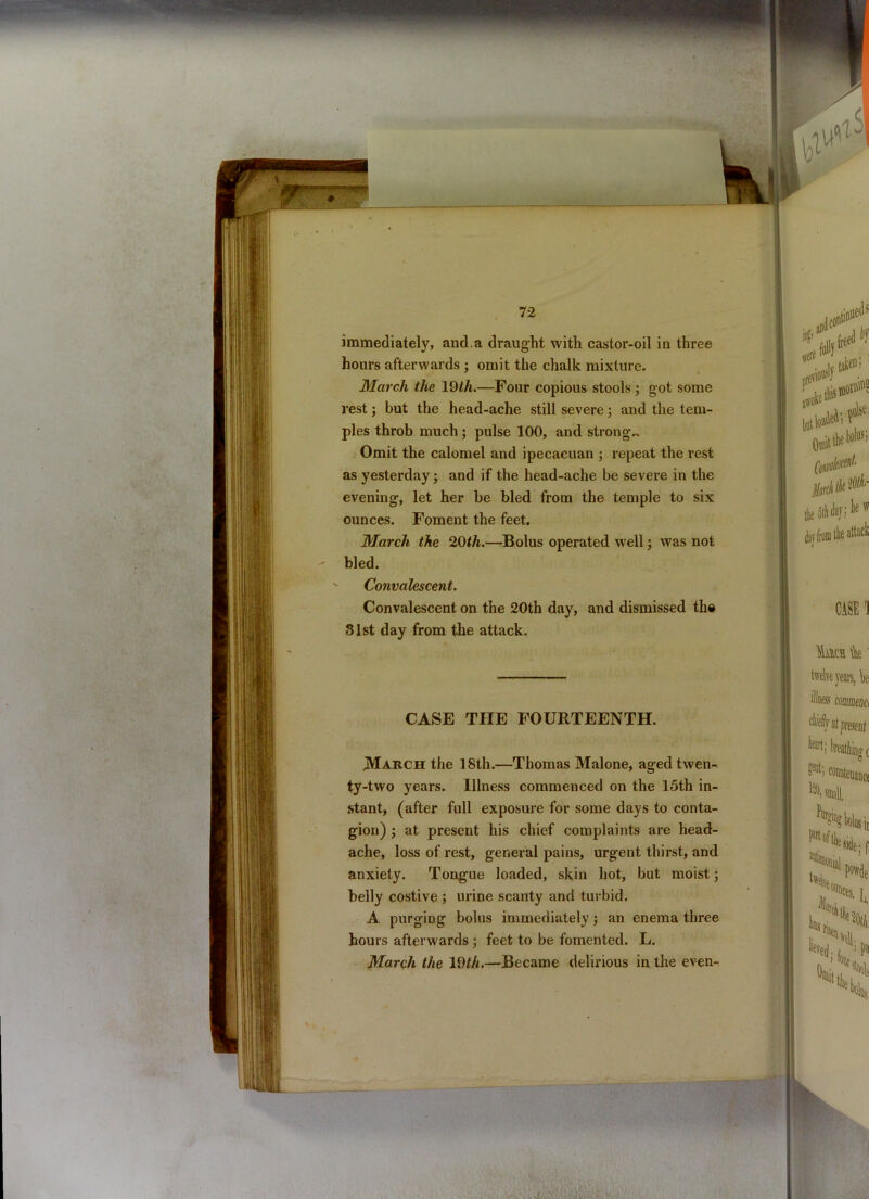 immediately, and.a draught with castor-oil in three hours afterwards ; omit the chalk mixture. March the 19th.—Four copious stools ; got some rest; but the head-ache still severe; and the tem- ples throb much; pulse 100, and strong.. Omit the calomel and ipecacuan ; repeat the rest as yesterday; and if the head-ache be severe in the evening, let her be bled from the temple to six ounces. Foment the feet. March the 20th.—Bolus operated well; was not bled. ' Convalescent. Convalescent on the 20th day, and dismissed th® Slst day from the attack. CASE THE FOURTEENTH. .March the 18th.—Thomas Malone, aged twen- ty-two years. Illness commenced on the 15th in- stant, (after full exposure for some days to conta- gion) ; at present his chief complaints are head- ache, loss of rest, general pains, urgent thirst, and anxiety. Tongue loaded, skin hot, but moist; belly costive ; urine scanty and turbid. A purging bolus immediately; an enema three hours afterwards ; feet to be fomented. L. March the 19th.—Became delirious in the even-