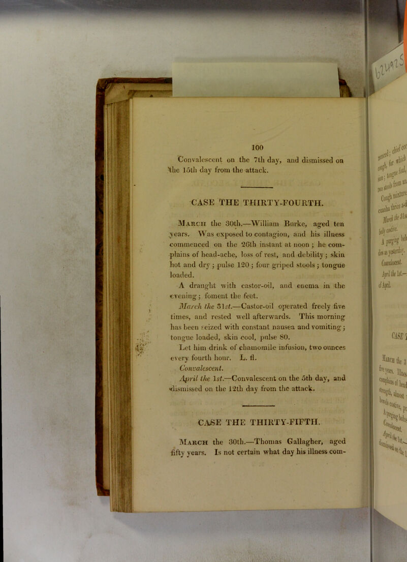 Convalescent on the 7th day, and dismissed on ’the 15th day from the attack. CASE THE THIRTY-FOURTH. / * March the 30th.—William Burke, aged ten .years. Was exposed to contagion, and his illness commenced on the 26th instant at noon ; he com- plains of head-ache, loss of rest, and debility ; skin hot and dry • pulse 120; four griped stools; tongue loaded. A draught with castor-oil, and enema in the evening • foment the feet. March the 31 si.—Castor-oil operated freely five times, and rested well afterwards. This morning has been seized with constant nausea and vomiting tongue loaded, skin cool, pulse 80. Let him drink of chamomile infusion, two ounces every fourth hour. L. 11. Convalescent. April the 1st.—Convalescent on the 5th day, and ’dismissed on the 12th day from the attack. CASE THE THIRTY-FIFTH. March the 30th.—Thomas Gallagher, aged fifty years. Is not certain what day his illness com-