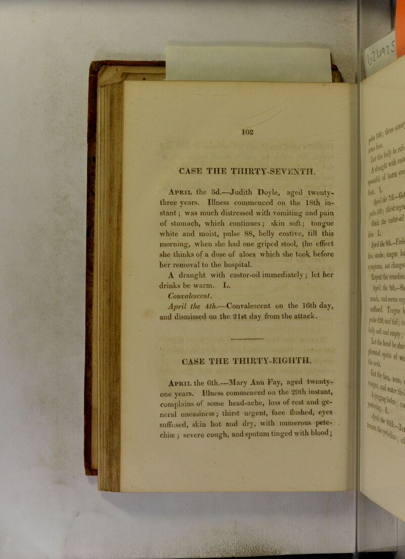 CASE THE THIRTY-SEVENTH. April the 3d.—Judith Doyle, aged twenty- three years. Illness commenced on the 18th in- stant ; was much distressed with vomiting and pain of stomach, which continues; skin soft; tongue white and moist, pulse 88, belly costive, till this morning, when she had one griped stool, the effect she thinks of a dose of aloes which she took before her removal to the hospital. A draught with castor-oil immediately ; let her drinks be warm. L. Convalescent. April the 4th.—Convalescent on the 16th day, and dismissed on the 21st day from the attack. CASE THE THIRTY-EIGHTH. April the 6th.—Mary Ann Fay, aged twenty-? one years. Illness commenced on the 29th instant, complains of some head-ache, loss of rest and ge- neral uneasiness; thirst urgent, face flushed, eyes suffused, skin hot and dry, with numerous pete- chiee ; severe cough, and sputum tinged with blood;