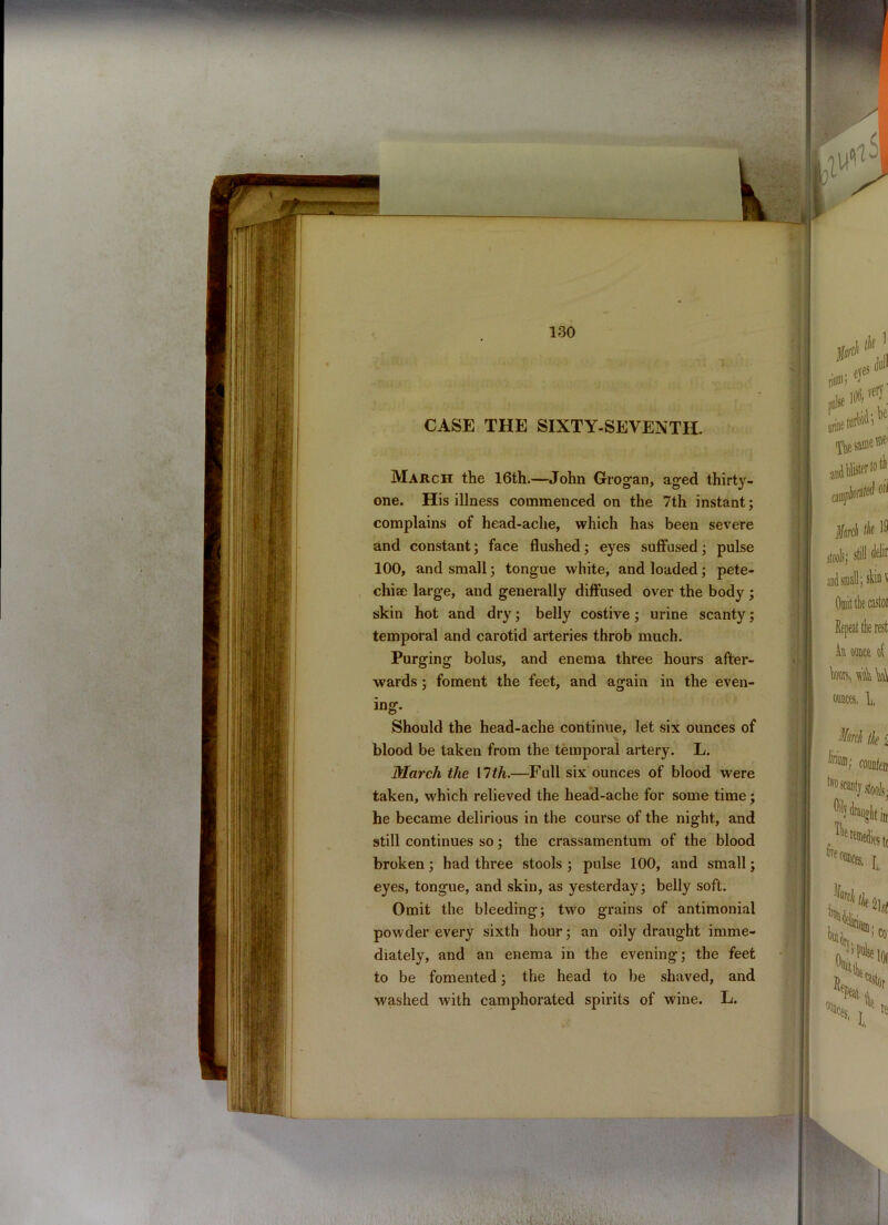 M-1 CASE THE SIXTY-SEVENTH. March the 16th.—John Grogan, aged thirty- one. His illness commenced on the 7th instant; complains of head-ache, which has been severe and constant; face flushed; eyes suffused; pulse 100, and small; tongue white, and loaded; pete- chise large, and generally diffused over the body ; skin hot and dry; belly costive; urine scanty; temporal and carotid arteries throb much. Purging bolus, and enema three hours after- wards ; foment the feet, and again in the even- Should the head-ache continue, let six ounces of blood be taken from the temporal artery. L. March the ilth.—Full six ounces of blood were taken, which relieved the head-ache for some time; he became delirious in the course of the night, and still continues so; the crassamentum of the blood broken; had three stools ; pulse 100, and small; eyes, tongue, and skin, as yesterday; belly soft. Omit the bleeding; two grains of antimonial powder every sixth hour; an oily draught imme- diately, and an enema in the evening; the feet to be fomented; the head to be shaved, and washed with camphorated spirits of wine. L.