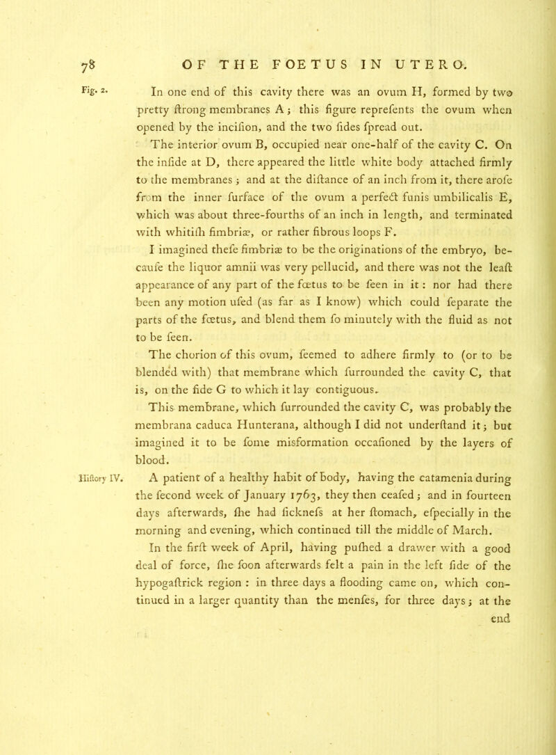 Fig. 2. Hiilory IV. In one end of this cavity there was an ovum H, formed by two pretty Strong membranes A ; this figure reprefents the ovum when opened by the incifion, and the two fides fpread out. The interior ovum B, occupied near one-naif of the cavity C. On the infide at D, there appeared the little white body attached firmly to the membranes; and at the diftance of an inch from it, there arofe from the inner furface of the ovum a perfect funis umbilicalis E, which was about three-fourths of an inch in length, and terminated with whitifh fimbria?, or rather fibrous loops F. I imagined thefe fimbria? to be the originations of the embryo, be- caufe the liquor amnii was very pellucid, and there was not the leafl appearance of any part of the foetus to be feen in it : nor had there been any motion ufed (as far as I know) which could feparate the parts of the foetus, and blend them fo minutely with the fluid as not to be feen. The chorion of this ovum, feemed to adhere firmly to (or to be blended with) that membrane which furrounded the cavity C, that is, on the fide G to which it lay contiguous. This membrane, which furrounded the cavity C, was probably the membrana caduca Hunterana, although I did not underhand it; but imagined it to be fome misformation occafioned by the layers of blood. A patient of a healthy habit of body, having the catamenia during the fecond week of January 1763, they then ceafed; and in fourteen days afterwards, fhe had ficknefs at her Stomach, especially in the morning and evening, which continued till the middle of March. In the firft week of April, having pufhed a drawer with a good deal of force, Ihe foon afterwards felt a pain in the left fide of the hypogaftrick region : in three days a flooding came on, which con- tinued in a larger quantity than the menfes, for three days; at the end