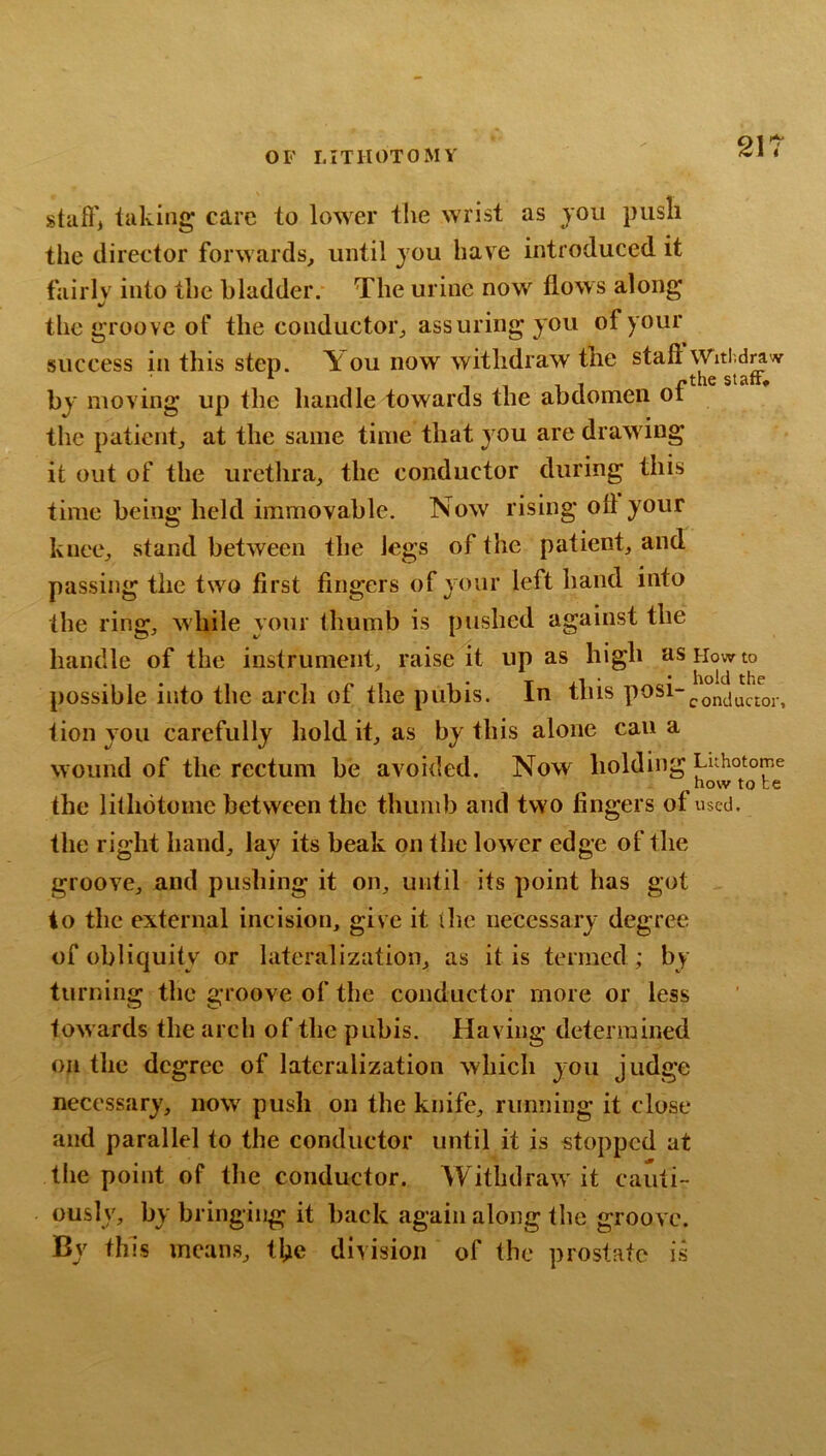staff', taking care to lower the wrist as jou push the director forwards, until you have introduced it fairlv into the bladder. The urine now flows along the groove of the conductor, assuring you of your success in this step. \ ou now withdraw the staff Withdraw by moving up the handle towards the abdomen of the patient, at the same time that you are drawing it out of the urethra, the conductor during this time being held immovable. Now rising off your knee, stand between the legs of the patient, and passing the two first fingers of your left hand into the ring, while your thumb is pushed against the handle of the instrument, raise it upas high as Howto possible into the arch of the pubis. In this tion you carefully hold it, as by this alone can a wound of the rectum be avoided. Now holding Luhotome now to te the lithdtoinc between the thumb and two fingers of used, tlie right hand, lay its beak on the lower edge of the groove, and pushing it on, until its point has got to the external incision, give it the necessary degree of obliquity or lateralization, as it is termed ; by turning the groove of the conductor more or less towards the arch of the pubis. Having determined on the degree of lateralization which you judge necessary, now push on the knife, running it close and parallel to the conductor until it is stopped at the point of tlie conductor. AVithdraw it cauti- ously, by bringing it back again along the groove. By this means, tl;ie division of the prostate is