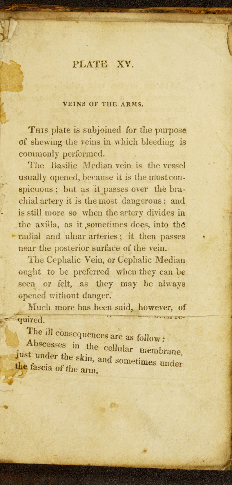 VEINS OF THE ARMS. This plate is subjoined for the purpose, of shewing the veins in which bleeding is coninionly performed. The Basilic Median vein is the vessel usually opened, because it is the most con- spicuous ; but as it passes over the bra- chial artery it is the most dangerous : and is still more so when the artery divides in _the axilla, as it,sometimes does, into th6 ^ radial and ulnar arteries; it then passes near the posterior surface of the vein. The Cephalic Vein, or Cephalic Median ought to be preferred when they can be seen or felt, as tiiey may be always opened without danger. Much more has been said^ quired. % ^sequences are as follow: ' ? Abscesses ,n the cellular meriibrant I fiiscia of the arm. f
