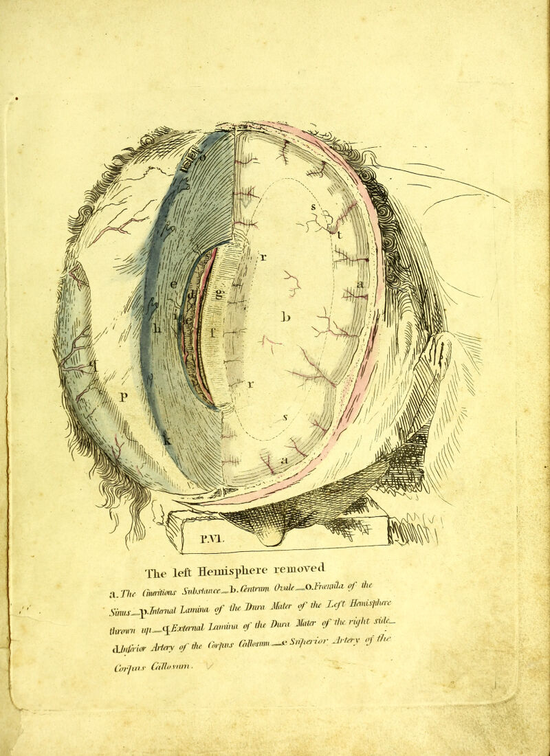 The left Hemisphere removed a The Cimitmu Sobstmue^b.Oirmm Ovak—OLrmaiUof Hu Sims-pJM U**» of Hu Jhua Mater of Hu Left UnUsfiurc auvm, u/,^External latnim of Hu Dura Meter of Hu right sirL, djnfirier Artery of Hu Oo-,,as Gtem -* Snf.aior Ar tery erf ike Car]w CiUos nm ■