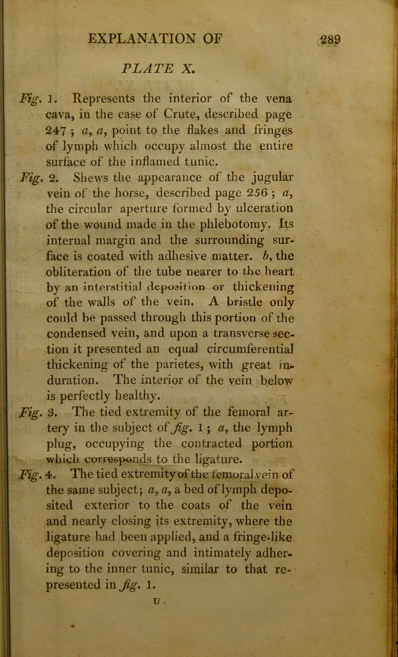 PLATE X. I Fig. 1. Represents the interior of the vena cava, in the case of Crute, described page 247 ; point to the flakes and fringes of lymph which occupy almost the entire surface of the inflamed tunic. , Fig. 2. Shews the appearance of the jugular vein of the horse, described page 256 j a, I the circular aperture formed by ulceration of the wound made in the phlebotomy. Its internal margin and the surrounding sur- face is coated with adhesive matter. 6, the obliteration of the tube nearer to the heart by an interstitial deposition or thickening of the walls of the vein. A bristle only I could be passed through this portion of the 1 condensed vein, and upon a transverse sec- tion it presented an equal circumferential thickening of the parietes, with great in^ duration. The interior of the vein below ■ is perfectly healthy. J Fig* 3. The tied extremity of the femoral ar^ I tery in the subject oi Jig. 1; a, the lymph plug, occupying the contracted portion II which corresponds to the ligature. || Fig. 4. The tied extremity of the femoral vein of II the same subject; «,«, a bed of lymph depo- II sited exterior to the coats of the vein I and nearly closing its extremity, where the I ligature had been applied, and a fringe-like I deposition covering and intimately adher- I ing to the inner tunic, similar to that re- I presented in Jig. 1. I u