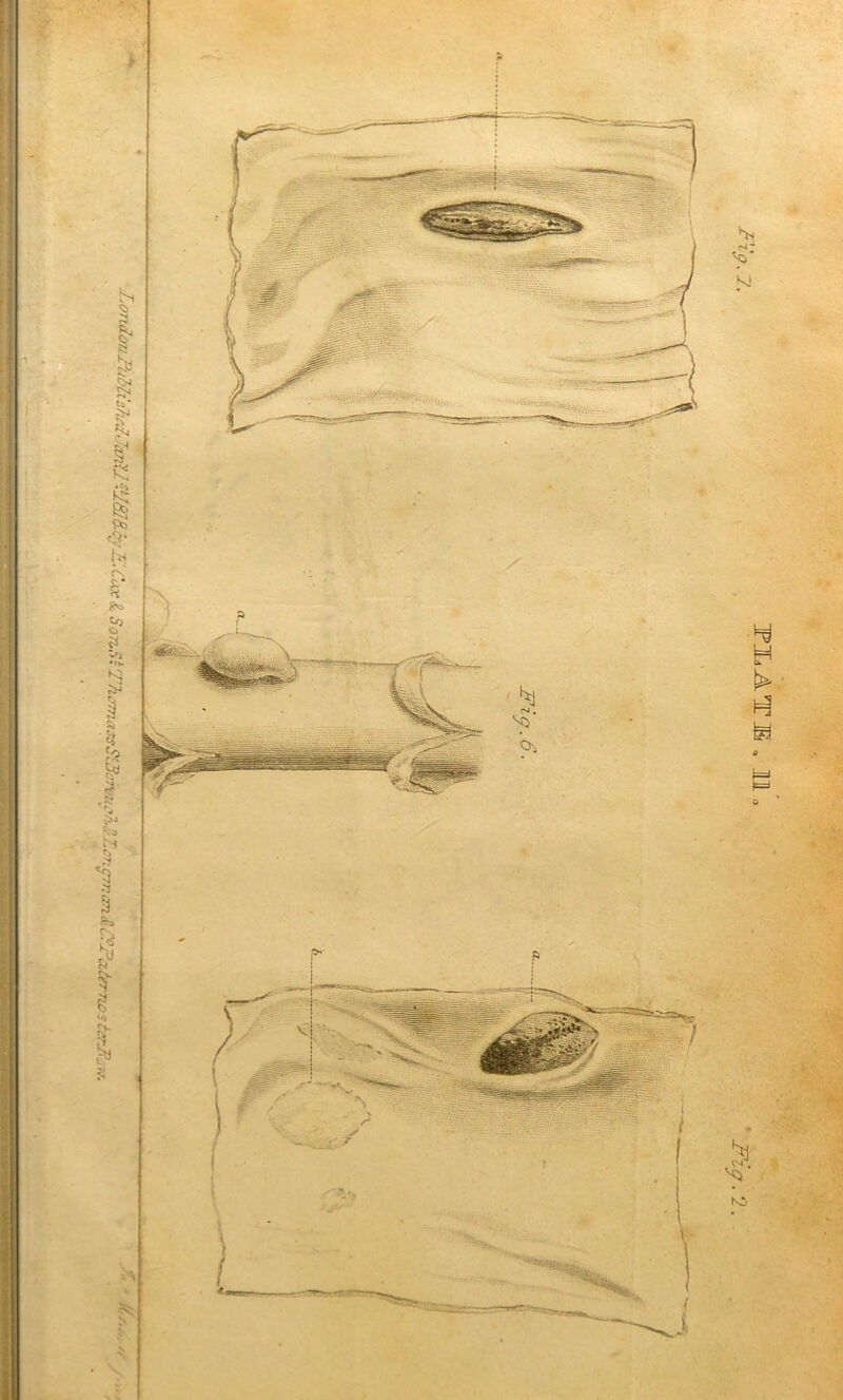 PiATB , 11