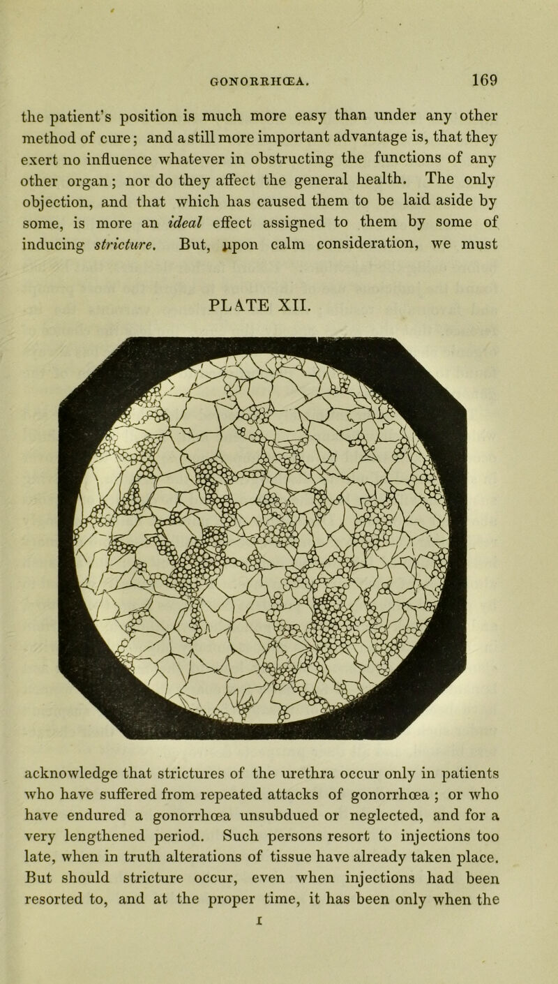 the patient’s position is much more easy than under any other method of cure; and a still more important advantage is, that they exert no influence whatever in obstructing the functions of any other organ; nor do they affect the general health. The only objection, and that which has caused them to be laid aside by some, is more an ideal effect assigned to them by some of inducing stricture. But, jipon calm consideration, we must PL A.TE XII. acknowledge that strictures of the urethra occur only in patients who have suffered from repeated attacks of gonorrhoea ; or who have endured a gonorrhoea unsubdued or neglected, and for a very lengthened period. Such persons resort to injections too late, when in truth alterations of tissue have already taken place. But should stricture occur, even when injections had been resorted to, and at the proper time, it has been only when the i