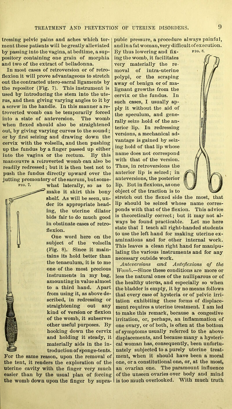 tressing pelvic pains and aches which tor- ment these patients will be greatly alleviated by passing into the vagina, at bedtime, a sup- pository containing one grain of morphia and two of the extract of belladonna. In most cases of retroversion or of retro- flexion it will prove advantageous to stretch out the contracted utero-sacral ligaments by the repositor (Fig. 7). This instrument is used by introducing the stem into the ute- rus, and then giving varying angles to it by a screw in the handle. In this manner a re- troverted womb can be temporarily forced into a state of anteversion. The womb when flexed should also be straightened out, by giving varying curves to the sound; or by first seizing and drawing down the cervix with the volsella, and then pushing up the fundus by a finger passed up either into the vagina or the rectum. By this manceuvre a retroverted womb can also be readily redressed ; but it is then best not to push the fundus directly upward over the jutting promontory of the sacrum, butsome- fig. 7. what laterally, so as to make it skirt this bony shelf. As will be seen, un- der its appropriate head- ing, the uterine dilator bids fair to do much good in obstinate cases of retro- flexion. One word here on the subject of the volsella (Fig. 8). Since it main- tains its hold better than the tenaculum, it is to me one of the most precious instruments in my bag, amounting in value almost to a third hand. Apart from using it, as above de- scribed, in redressing or straightening out any kind of version or flexion of the womb, it subserves other useful purposes. By hooking down the cervix and holding it steady, it materially aids in the in- troduction of sponge-tents. For the same reason, upon the removal of the tent, it renders the exploration of the uterine cavity with the finger very much easier than by the usual plan of forcing the womb down upon the finger by supra- pubic pressure, a procedure always painful, and in a fat woman, very difficult of execution. By thus lowering and fix- ing the womb, it facilitates very materially the re- moval of intra-uterine polypi, or the scraping away of benign or of ma- lignant growths from the cervix or the fundus. In such cases, I usually ap- ply it without the aid of the speculum, and gene- rally seize hold of the an- terior lip. In redressing versions, a mechanical ad- vantage is gained by seiz- ing hold of that lip whose name does not correspond with that of the version. Thus, in retroversions the anterior lip is seized; in anteversion s, the posterior lip. But in flexions, as one object of the traction is to stretch out the flexed side the most, that lip should be seized whose name corres- ponds with that of the flexion. This advice is theoretically correct; but it may not al- ways be found practicable. Let me here state that I teach all right-handed students to use the left hand for making uterine ex- aminations and for other internal work. This leaves a clean right hand for manipu- lating the various instruments and for any necessary outside work. Anteversions and Anteflexions of the Womb.—Since these conditions are more or less the natural ones of the nulliparous or of the healthy uterus, and especially so when the bladder is empty, it by no means follows that every case of hysteria or of pelvic irri- tation exhibiting these forms of displace- ment requires a uterine treatment. I am led to make this remark, because a congestive irritation, or, perhaps, an inflammation of one ovary, or of both, is often at the bottom of symptoms usually referred to the above displacements, and because many a hysteri- cal woman has, consequently, been unfortu- nately subjected to a purely uterine treat- ment, when it should have been a moral one, or a constitutional one, or, at the most, an ovarian one. The paramount influence of the unseen ovaries over body and mind is too much overlooked. With much truth