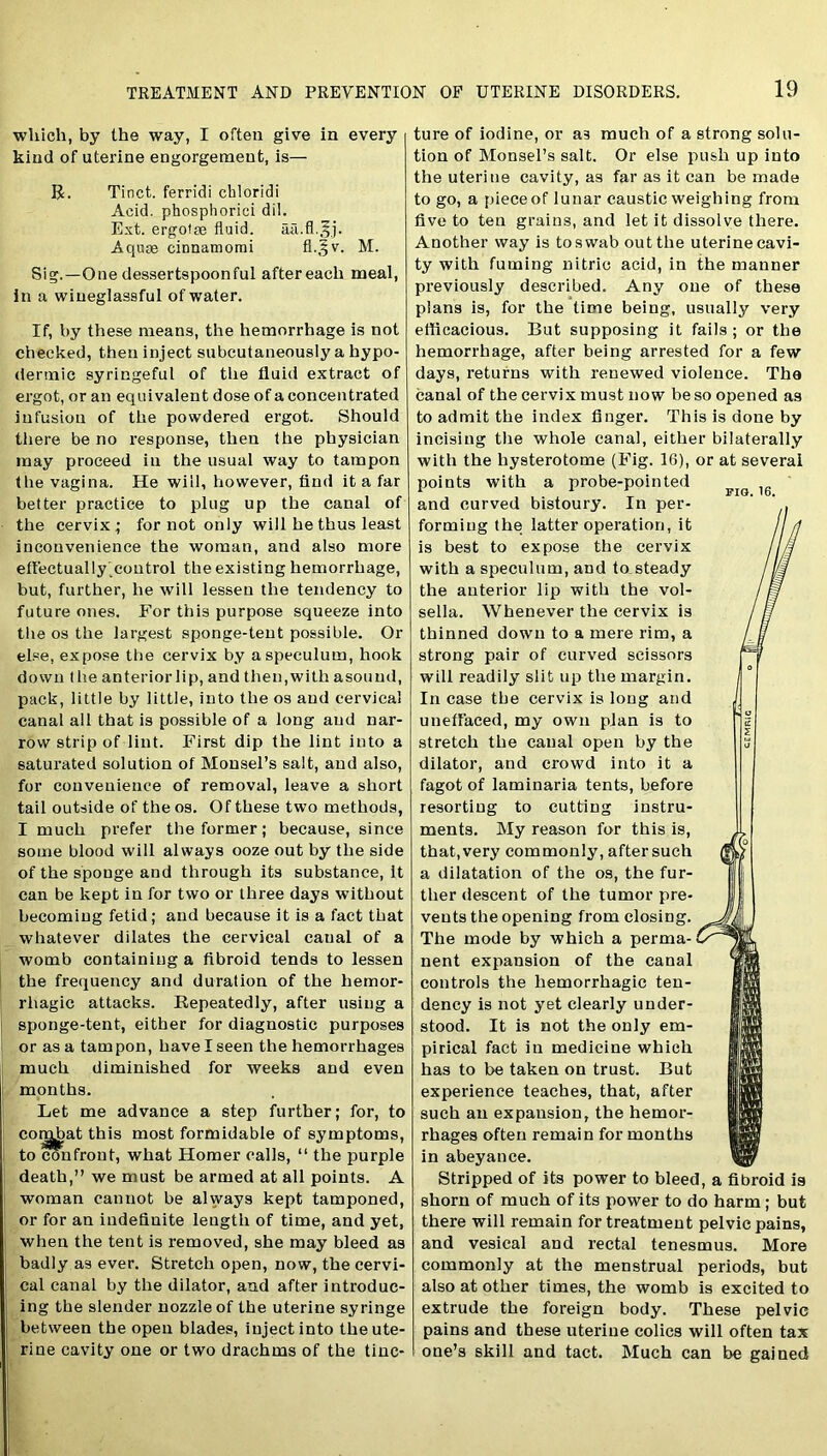 which, by the way, I often give in every kind of uterine engorgement, is— R. Tinct. ferridi chloridi Acid, phospliorici dil. Ext. ergotte fluid. aa.fl.^j. Aquae cinnamomi fl.^v. M. Sig.—One dessertspoonful after each meal, in a wiueglassful of water. If, by these means, the hemorrhage is not checked, then inject subcutaneously a hypo- dermic syringeful of the fluid extract of ergot, or an equivalent dose of a concentrated infusion of the powdered ergot. Should there be no response, then the physician may proceed in the usual way to tampon the vagina. He will, however, find it a far better practice to plug up the canal of the cervix; for not only will he thus least inconvenience the woman, and also more effectually control the existing hemorrhage, but, further, he will lessen the tendency to future ones. For this purpose squeeze into the os the largest sponge-tent possible. Or else, expose the cervix by a speculum, hook down the anteriorlip, and then,with asound, pack, little by little, into the os and cervical canal all that is possible of a long and nar- row strip of lint. First dip the lint into a saturated solution of Monsel’s salt, and also, for convenience of removal, leave a short tail outside of the os. Of these two methods, I much prefer the former; because, since some blood will always ooze out by the side of the sponge and through its substance, it can be kept in for two or three days without becoming fetid ; and because it is a fact that whatever dilates the cervical caual of a womb containing a fibroid tends to lessen the frequency and duration of the hemor- rhagic attacks. Repeatedly, after using a sponge-tent, either for diagnostic purposes or as a tampon, have I seen the hemorrhages much diminished for weeks and even months. Let me advance a step further; for, to corr^at this most formidable of symptoms, to confront, what Homer calls, “ the purple death,” we must be armed at all points. A woman cannot be always kept tamponed, or for an indefinite length of time, and yet, when the tent is removed, she may bleed as badly as ever. Stretch open, now, the cervi- cal canal by the dilator, and after introduc- ing the slender nozzle of the uterine syringe between the open blades, inject into the ute- rine cavity one or two drachms of the tinc- ture of iodine, or a3 much of a strong solu- tion of Monsel’s salt. Or else push up into the uterine cavity, as far as it can be made to go, a piece of lunar caustic weighing from five to ten grains, and let it dissolve there. Another way is to swab out the uterine cavi- ty with fuming nitric acid, in the manner previously described. Any one of these plans is, for the time being, usually very efiicacious. But supposing it fails ; or the hemorrhage, after being arrested for a few days, returns with renewed violence. The canal of the cervix must now be so opened as to admit the index finger. This is done by incising the whole canal, either bilaterally with the hysterotome (Fig. 16), or at several points with a probe-pointed and curved bistoury. In per- forming the latter operation, it is best to expose the cervix with a speculum, and to steady the anterior lip with the vol- sella. Whenever the cervix is thinned down to a mere rim, a strong pair of curved scissors will readily slit up the margin. In case the cervix is long and unefiaced, my own plan is to stretch the caual open by the dilator, and crowd into it a fagot of laminaria tents, before resorting to cutting instru- ments. My reason for this is, that, very commonly, after such a dilatation of the os, the fur- ther descent of the tumor pre- vents the opening from closing. The mode by which a perma- nent expansion of the canal controls the hemorrhagic ten- dency is not yet clearly under- stood. It is not the only em- pirical fact in medicine which has to be taken on trust. But experience teaches, that, after such an expansion, the hemor- rhages often remain for months in abeyance. Stripped of its power to bleed, a fibroid is shorn of much of its power to do harm; but there will remain for treatment pelvic pains, and vesical and rectal tenesmus. More commonly at the menstrual periods, but also at other times, the womb is excited to extrude the foreign body. These pelvic pains and these uterine colics will often tax one’s skill and tact. Much can be gained