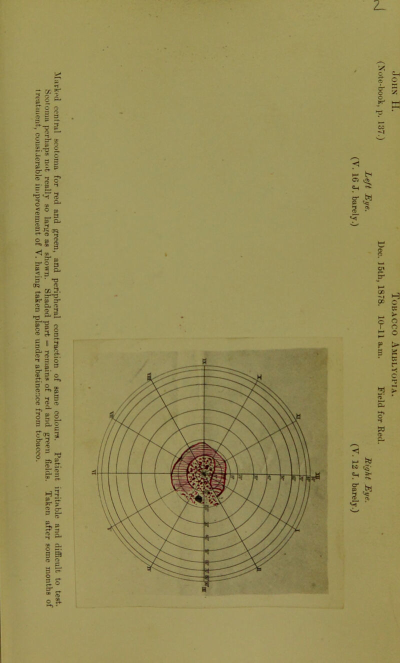 Marked central scotoma for red and green, and peripheral contraction of same colours. Patient irritable and difficult to test. Scotoma perhaps not really so lar^e as shown. Shaded part = remains of red and green fields. Taken after some months of treatment., considerable improvement of V. having taken place under abstinence from tobacco. 2_ John H. Tobacco Amblyopia. (Note-book, p. 137.) Dee. 15th, 1878. 10-11 a.m. Field for Red. Lejt Eye. Right Eye. (V. 16 J. barely.) (Y. 12 J. barely.)