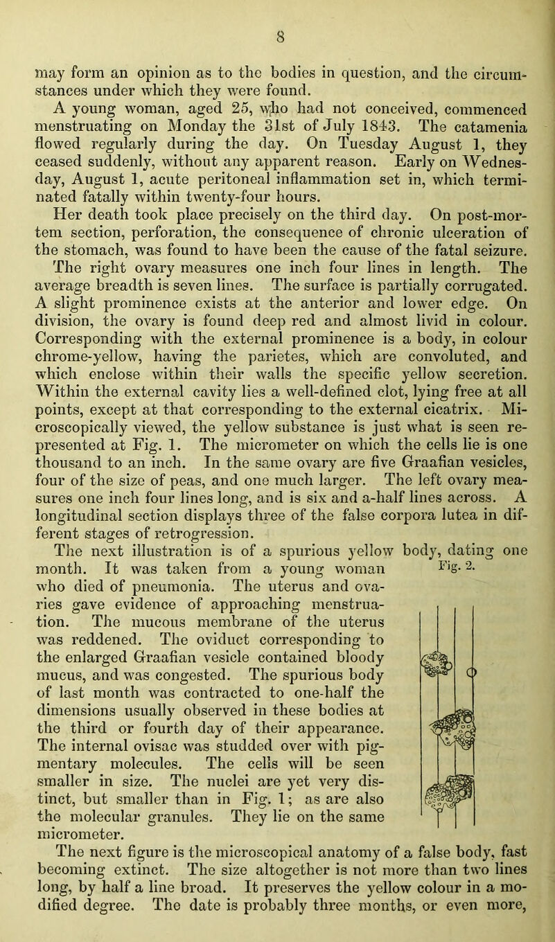 may form an opinion as to the bodies in question, and the circum- stances under which they were found. A young woman, aged 25, w^ho had not conceived, commenced menstruating on Monday the 31st of July 1843. The catamenia flowed regularly during the day. On Tuesday August 1, they ceased suddenly, without any apparent reason. Early on Wednes- day, August 1, acute peritoneal inflammation set in, which termi- nated fatally within twenty-four hours. Her death took place precisely on the third day. On post-mor- tem section, perforation, the consequence of chronic ulceration of the stomach, was found to have been the cause of the fatal seizure. The right ovary measures one inch four lines in length. The average breadth is seven lines. The surface is partially corrugated. A slight prominence exists at the anterior and lower edge. On division, the ovary is found deep red and almost livid in colour. Corresponding with the external prominence is a body, in colour chrome-yellow, having the parietes, which are convoluted, and which enclose within their walls the specific yellow secretion. Within the external cavity lies a well-defined clot, lying free at all points, except at that corresponding to the external cicatrix. Mi- croscopically viewed, the yellow substance is just what is seen re- presented at Fig. 1. The micrometer on which the cells lie is one thousand to an inch. In the same ovary are five Graafian vesicles, four of the size of peas, and one much larger. The left ovary mea- sures one inch four lines long, and is six and a-half lines across. A longitudinal section displays three of the false corpora lutea in dif- ferent stages of retrogression. The next illustration is of a spurious yellow body, dating one who died of pneumonia. The uterus and ova- ries gave evidence of approaching menstrua- tion. The mucous membrane of the uterus was reddened. The oviduct corresponding to the enlarged Graafian vesicle contained bloody mucus, and was congested. The spurious body of last month was contracted to one-half the dimensions usually observed in these bodies at the third or fourth day of their appearance. The internal ovisac was studded over with pig- mentary molecules. The cells will be seen smaller in size. The nuclei are yet very dis- tinct, but smaller than in Fig. 1; as are also the molecular granules. They lie on the same raici’ometer. The next figure is the microscopical anatomy of a false body, fast becoming extinct. The size altogether is not more than two lines long, by half a line broad. It preserves the yellow colour in a mo- dified degree. The date is probably three months, or even more,