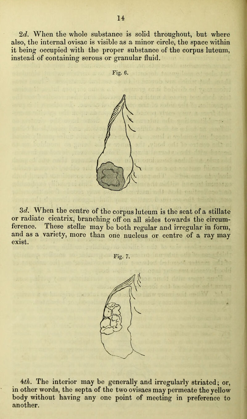 u 2d. When the whole substance is solid throughout, but where also, the internal ovisac is visible as a minor circle, the space within it being occupied with the proper substance of the corpus luteum, instead of containing serous or granular fluid. Fig. 6. 3d. When the centre of the corpus luteum is the seat of a stillate or radiate cicatrix, branching off on all sides towards the circum- ference. These stellse may be both regular and irregular in form, and as a variety, more than one nucleus or centre of a ray may exist. Fig. 7. 4ith. The interior may be generally and irregularly striated; or, in other words, the septa of the two ovisacs may permeate the yellow body without having any one point of meeting in preference to another.