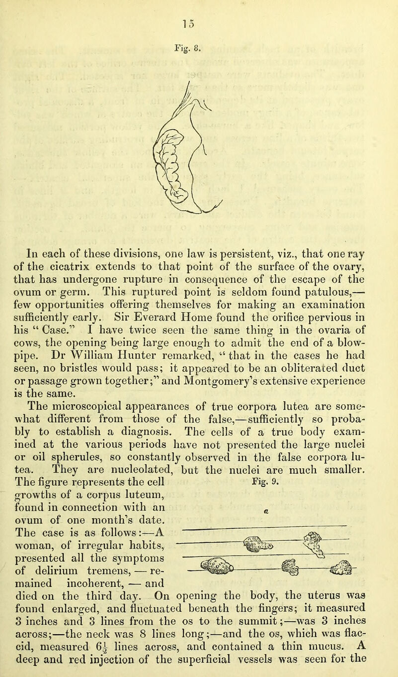 Fig. 8. In each of these divisions, one law is persistent, viz., that one ray of the cicatrix extends to that point of the surface of the ovary, that has undergone rupture in consequence of the escape of the ovum or germ. This ruptured point is seldom found patulous,— few opportunities olfering themselves for making an examination sufficiently early. Sir Everard Home found the orifice pervious in his “ Case.” I have twice seen the same thinw in the ovaria of O cows, the opening being large enough to admit the end of a blow- pipe. Dr William Hunter remarked, “ that in the cases he had seen, no bristles would pass; it appeared to be an obliterated duct or passage grown together;” and Montgomery’s extensive experience is the same. The microscopical appearances of true corpora lutea are some- what different from those of the false,—sufficiently so proba- bly to establish a diagnosis. The cells of a true body exam- ined at the various periods have not presented the large nuclei or oil spherules, so constantly observed in the false corpora lu- tea. They are nucleolated, but the nuclei are much smaller. The figure represents the cell Fig. 9. growths of a corpus luteum, found in connection with an „ ovum of one month’s date. ^ The case is as follows:—A woman, of irregular habits, presented all the symptoms of delirium tremens, — re- mained incoherent, — and died on the third day. On opening the body, the uterus was found enlarged, and fluctuated beneath the Angers; it measured 3 inches and 3 lines from the os to the summit;—was 3 inches across;—the neck was 8 lines long;—and the os, which was flac- cid, measured 6^ lines across, and contained a thin mucus. A deep and red injection of the superficial vessels was seen for the
