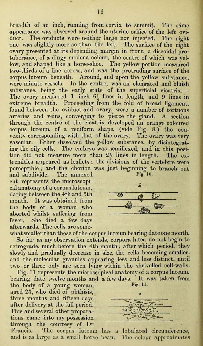 breadth of an inch, running from cervix to summit. The same appearance was observed around the uterine orifice of the left ovi- duct. The oviducts were neither large nor injected. The right one was slightly more so than the left. The surface of the right ovary presented at its depending margin in front, a discoidal pro- tuberance, of a dingy modena colour, the centre of which was yel- low, and shaped like a horse-shoe. The yellow portion measured two-thirds of a line across, and was the protruding surface of the corpus luteum beneath. Around, and upon the yellow substance, were minute vessels. In the centre, was an elongated and bluish substance, being the early state of the superficial cicatrix.— The ovary measured 1 inch 6^ lines in length, and 9 lines in extreme breadth. Proceeding from the fold of broad ligament, found between the oviduct and ovary, were a number of tortuous arteries and veins, converging to pierce the gland. A section through the centre of the cicatrix developed an orange coloured corpus luteum, of a reniform shape, (vide Fig. 8,) the con- vexity corresponding with that of the ovary. The ovary was very vascular. Ether dissolved the yellow substance, by disintegrat- ing the oily cells. The embryo was semiflexed, and in this posi- tion did not measure more than 2^ lines in length. The ex- tremities appeared as leaflets ; the divisions of the vertebrae were perceptible ; and the chorion was just beginning to branch out and subdivide. The annexed Fig. lo. cut represents the microscopi- cal anatomy of a corpus luteum, dating between the 4th and 5th aborted whilst suffering from fever. She died a few days afterwards. The cells are some- what smaller than those of the corpus luteum bearing date one month. So far as my observation extends, corpora lutea do not begin to retrograde, much before the 4th month; after which period, they slowly and gradually decrease in size, the cells becoming smaller, and the molecular granules appearing less and less distinct, until two or three only are seen lying within the shrivelled cell-walls. Fig. 11 represents the microscopical anatomy of a corpus luteum, bearing date twelve months and a few days. It was taken from the body of a young woman. Fig. il. aged 23, who died of phthisis, ^ three months and fifteen days ■— - through the courtesy of Dr Francis. The corpus luteum has a lobulated circumference, and is as large as a small horse bean. The colour approximates month. It was obtained from the body of a woman who after delivery at the full period. This and several other prepara- tions came into my possession