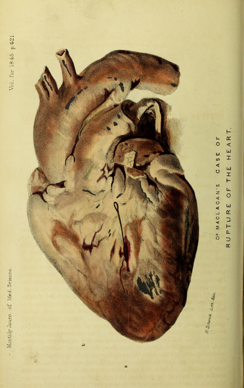 Moritulv Journ. of Med. Science. Vol. for 18 45. p.4.21 CO D« MACLACAN’