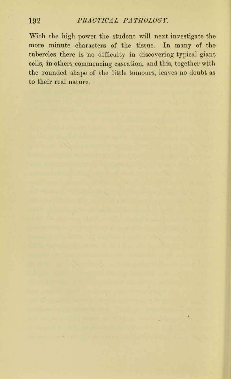 With the high power the student will next investigate the more minute characters of the tissue. In many of the tubercles there is no difficulty in discovering typical giant cells, in others commencing caseation, and this, together with the rounded shape of the little tumours, leaves no doubt as to their real nature.