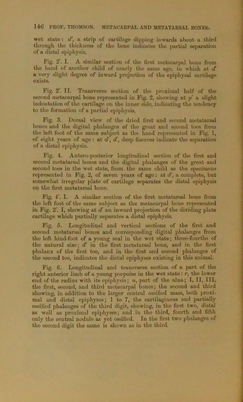 14G PROF. THOMSON. METACARPAL AND METATARSAL BONES. wet state ; d\ a strip of cartilage di])ping inwards about a third through the thickness of the bone indicates the partial separation of a distal epi|)hysi3. Fig. 2'. I. A similar section of the fii-st metacarpal bone from the hand of another child of nearly the same age, in which at it a very slight degree of inward ja’ojection of the epiphysal cartilage exists. Fig. 2'. II. Transverse section of the proximal half of the second metacarpal bone represented in Fig. 2, showing at p a slight indentation of the cartilage on the inner side, indicating the tendency to the formation of a partial epii)hysi8. Fig. 3. Dorsal view of the dried first and second metatarsal bones and the digital phalanges of the great and second toes from the left foot of the same subject as the hand represented in Fig. 1, of eight years of ago : at d', d', deep fissures indicate the sepamtion of a distal epiphysis. Fig. 4. Antero-posterior longitudinal section of the first and second metatarsal bones and the digital phalanges of the great and second toes in the wet state, from the same child as the si)ecimens represented in Fig. 2, of seven years of age : at d\ a comj)lete, but somewhat irregular plate of cartilage sepamtes the distal epiphysis on the first metatarsal bone. Fig. 4'. I. A similar section of the first metatarsal bone from the left foot of the same subject as the metacarpal bone represented in Fig. 2'. I, showing at d an inward projection of the dividing plate cartilage which partially separates a dist^ epiphysis. Fig. 5. Longitudinal and vertical sections of the first and second metatarsal bones and corresponding digital phalanges from the left hind-foot of a young seal in the wet state; three-fourths of the natural size; d' in the fii’st metatarsal bone, and in the first phalanx of the first toe, and in the first and second phalanges of the second toe, indicates the distal epiphyses existing in this animal. Fig. 6. Longitudinal and transverse section of a part of the right anterior limb of a young porpoise in the wet state: r, the lower end of the radius with its epiphysis; u, part of the ulna; I, II, III, the first, second, and third metacarpal bones; the second and third showing, in addition to the larger central ossified maas, both proxi- mal and distill epiphyses; 1 to 7, the cartilaginous and partially ossifi(;d phalanges of the third digit, showing, in the fir.st two, distal as well as proximal epiphyses; and in the third, fourth and fifth only the centnil nodule as yet ossified. In the first two phalanges of the second digit the same is shown as in the third.