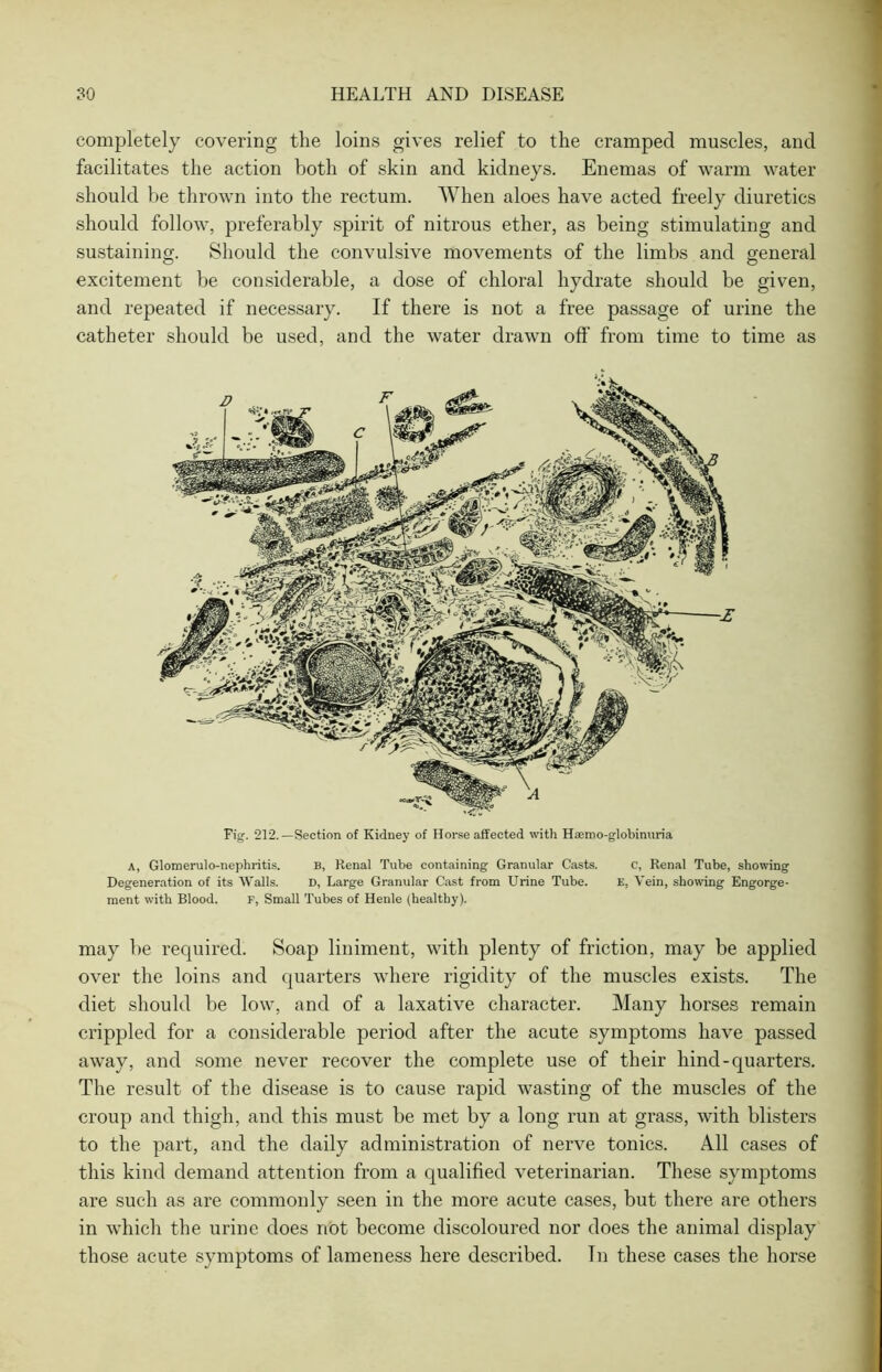 completely covering the loins gives relief to the cramped muscles, and facilitates the action both of skin and kidneys. Enemas of warm water should be thrown into the rectum. When aloes have acted freely diuretics should follow, preferably spirit of nitrous ether, as being stimulating and sustaining. Should the convulsive movements of the limbs and general excitement be considerable, a dose of chloral hydrate should be given, and repeated if necessary. If there is not a free passage of urine the catheter should be used, and the water drawn off from time to time as Fig. 212.—Section of Kidney of Horse affected with Haemo-globinuria a, Glomerulo-nephritis. b, Renal Tube containing Granular Casts. c, Renal Tube, showing Degeneration of its Walls. D, Large Granular Cast from Urine Tube. E, Vein, showing Engorge- ment with Blood. F, Small Tubes of Henle (healthy). may be required. Soap liniment, with plenty of friction, may be applied over the loins and quarters where rigidity of the muscles exists. The diet should be low, and of a laxative character. Many horses remain crippled for a considerable period after the acute symptoms have passed away, and some never recover the complete use of their hind-quarters. The result of the disease is to cause rapid wasting of the muscles of the croup and thigh, and this must be met by a long run at grass, with blisters to the part, and the daily administration of nerve tonics. All cases of this kind demand attention from a qualified veterinarian. These symptoms are such as are commonly seen in the more acute cases, but there are others in which the urine does not become discoloured nor does the animal display those acute symptoms of lameness here described. In these cases the horse