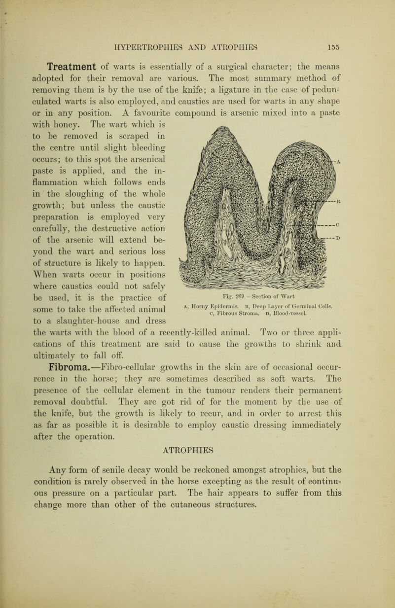 Treatment of warts is essentially of a surgical character; the means adopted for their removal are various. The most summary method of removing them is by the use of the knife; a ligature in the case of pedun- culated warts is also employed, and caustics are used for warts in any shape or in any position. A favourite compound is arsenic mixed into a paste with honey. The wart which is to be removed is scraped in the centre until slight bleeding occurs; to this spot the arsenical paste is applied, and the in- flammation which follows ends in the sloughing- of the whole growth; but unless the caustic preparation is employed very carefully, the destructive action of the arsenic will extend be- yond the wart and serious loss of structure is likely to happen. When warts occur in positions where caustics could not safely be used, it is the practice of some to take the affected animal to a slaughter-house and dress the warts with the blood of a recently-killed animal. Two or three appli- cations of this treatment are said to cause the growths to shrink and ultimately to fall off'. Fibroma.—Fibro-cellular growths in the skin are of occasional occur- rence in the horse; they are sometimes described as soft warts. The presence of the cellular element in the tumour renders their permanent removal doubtful. They are got rid of for the moment by the use of the knife, but the growth is likely to recur, and in order to arrest this as far as possible it is desirable to employ caustic dressing immediately after the operation. ATROPHIES Any form of senile decay would be reckoned amongst atrophies, but the condition is rarely observed in the horse excepting as the result of continu- ous pressure on a particular part. The hair appears to suffer from this change more than other of the cutaneous structures. Fig. 269.—Section of Wart a, Horny Epidermis, b, Deep Layer of Germinal Cells. C, Fibrous Stroma. D, Blood-vessel.